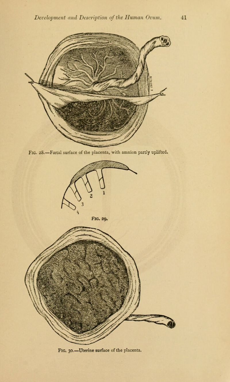 FlG. 28.—Foetal surface of the placenta, with amnion partly uplifted. Fig. 29. Fig. 30.—Uterine surface of the placenta.