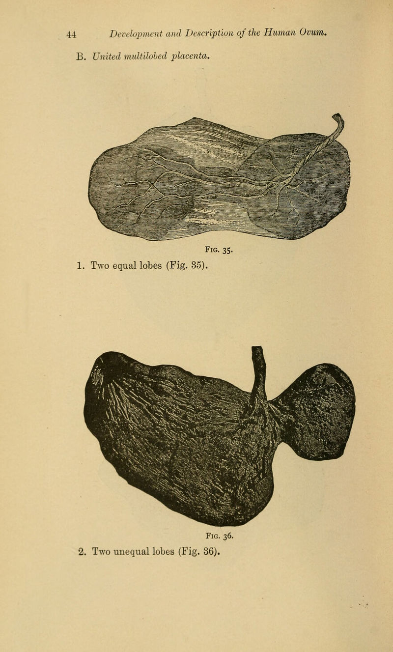 B. United multilobed placenta. Fig. 35. 1. Two equal lobes (Fig. 35). Fig. 36. 2. Two unequal lobes (Fig. 36).