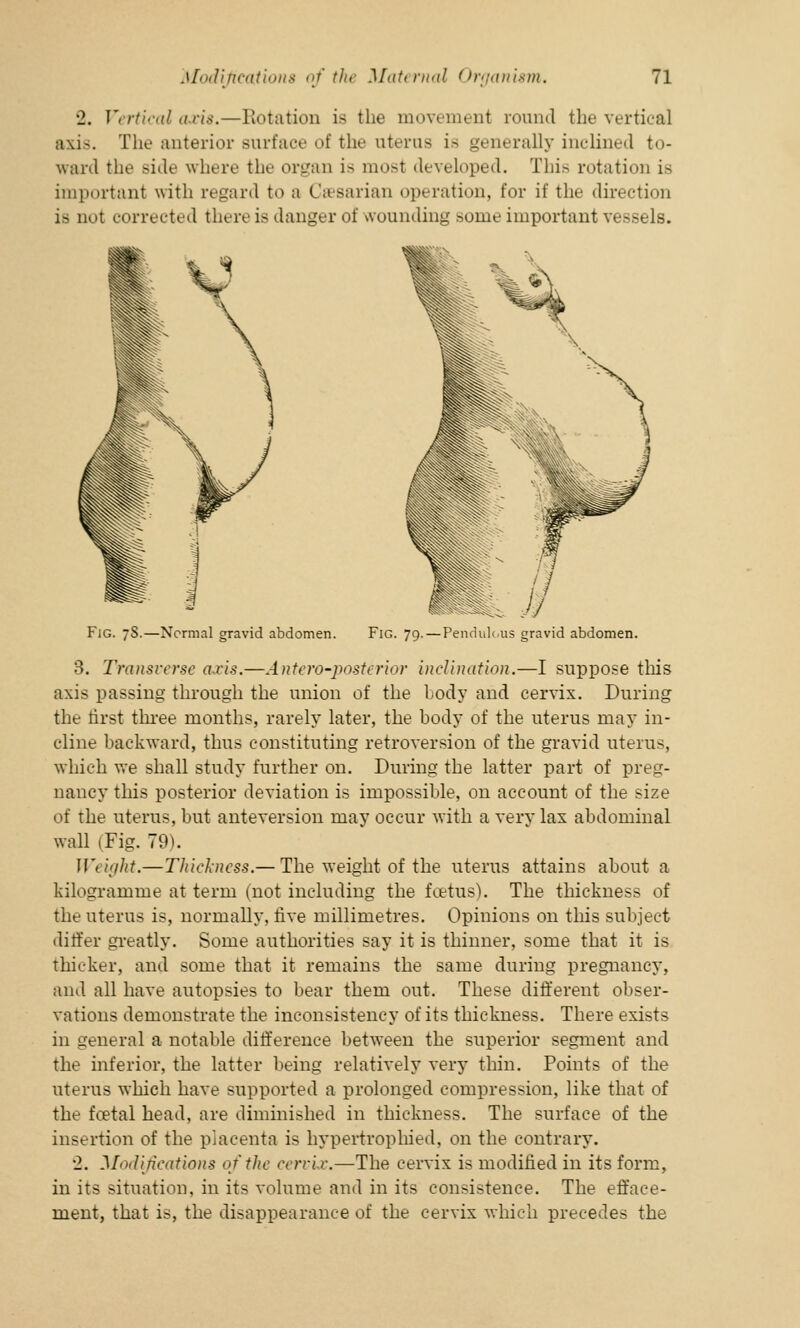 2. Vertical axis.—Rotation is the movement round the vertical axis. The anterior Burface of the uterus is generally inclined to- ward the Bide where the organ is most developed. This rotation is important with regard to a Casarian operation, for if the direction is not corrected there is danger of wounding some important vessels. Fig. 7S.—Normal gravid abdomen. Fig. 79.—Pendulous gravid abdomen. 3. Transverse axis.—Antero-posterior inclination.—I suppose this axis passing through the union of the body and cervix. During the first three months, rarely later, the body of the uterus may in- cline backward, thus constituting retroversion of the gravid uterus, which we shall study further on. During the latter part of preg- nancy this posterior deviation is impossible, on account of the size of the uterus, but anteversion may occur with a very lax abdominal wall (Fig. 79). Weight.—Thickness.— The weight of the uterus attains about a kilogramme at term (not including the foetus). The thickness of the uterus is, normally, rive millimetres. Opinions on this subject differ greatly. Some authorities say it is thinner, some that it is thicker, and some that it remains the same during pregnancy, and. all have autopsies to bear them out. These different obser- vations demonstrate the inconsistency of its thickness. There exists in general a notable difference between the superior segment and the inferior, the latter being relatively very thin. Points of the uterus which have supported a prolonged compression, like that of the foetal head, are diminished in thickness. The surface of the insertion of the placenta is hypertrophied, on the contrary. 2. Modifications of the cervix.—The cervix is modified in its form, in its situation, in its volume and in its consistence. The effaee- ment, that is, the disappearance of the cervix which precedes the