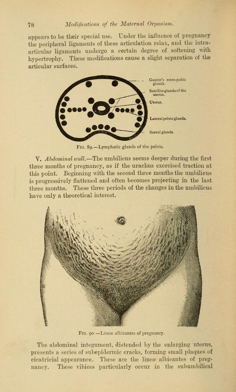 appears to be their special use. Under the influence of pregnancy the peripheral ligaments of these articulation relax, and the intra- articular ligaments undergo a certain degree of softening with hypertrophy. These modifications cause a slight separation of the articular surfaces. - _ Guerin's retro-pubic glands. Satellite glands of the uterus. Uterus. Lateral pelvic glands. Sacral glands. —Lymphatic glands of the pelvis. V. Abdominal wall.—The umbilicus seems deeper during the first three months of pregnancy, as if the urachus exercised traction at this point. Beginning with the second three months the umbilicus is progressively flattened and often becomes projecting in the last three months. These three periods of the changes in the umbilicus have only a theoretical interest. Fig. 90 —Linese alblcantes of pregnancy. The abdominal integument, distended by the enlarging uterus, presents a series of subepidermic cracks, forming small plaques of cicatricial appearance. These are the linene albicantes of preg- nancy. These vibices particularly occur in the subumbilical