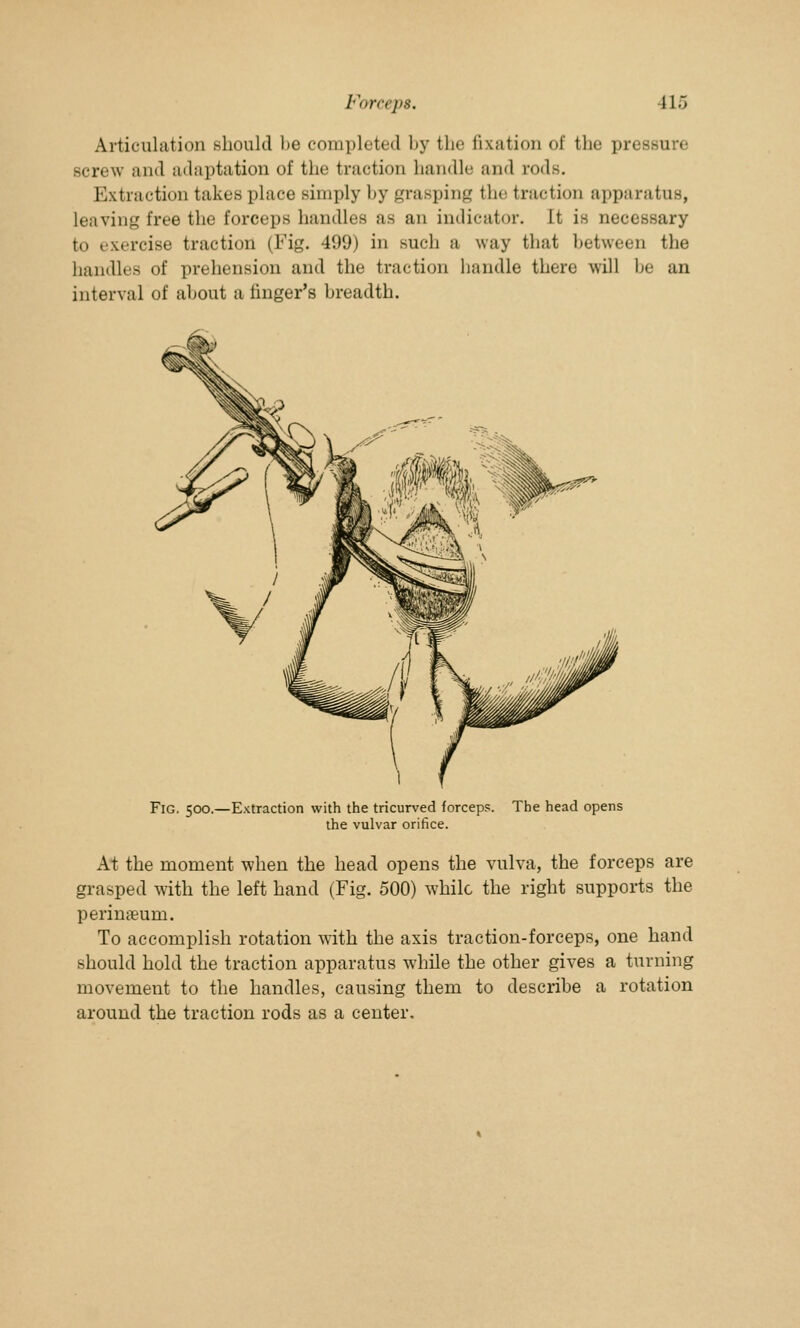 Articulation should be completed by the fixation of the pressu *e screw and adaptation of the traction handle and rods. Extraction takes place simply by grasping the traction apparatus, leu ving free the forceps handles as an indicator. It is necessary to exercise traction (Fig. 499) in such a way that between the handles of prehension and the traction handle there will be an interval of about a finger's breadth. Fig. 500.—Extraction with the tricurved forceps. The head opens the vulvar orifice. At the moment when the head opens the vulva, the forceps are grasped with the left hand (Fig. 500) while the right supports the perinaeum. To accomplish rotation with the axis traction-forceps, one hand should hold the traction apparatus while the other gives a turning movement to the handles, causing them to describe a rotation around the traction rods as a center.