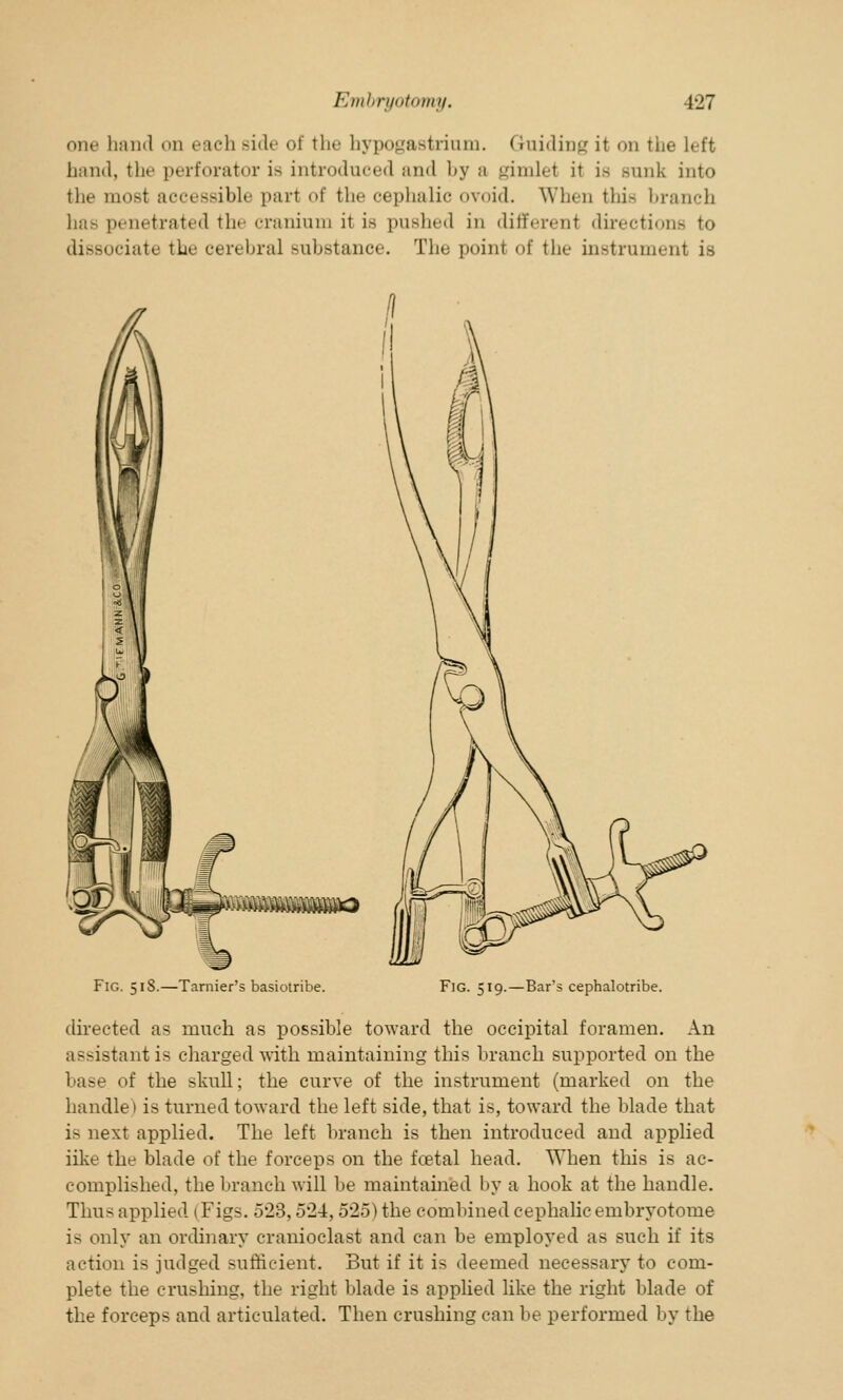 one hand on each side of the hypogastriam. (raiding it on the left hand, the perforatoi is introduced and by a gimlei it is sunk into tin- mosl accessible pari of the cephalic ovoid. When this branch has penetrated the cranium it is pushed in different directions to dissociate the cerebral Bubstance. The point of the instrument is Fig. 518.—Tarnier's basiotribe. Fig. 519.—Bar's cephalotribe. directed as much as possible toward the occipital foramen. An assistant is charged with maintaining this branch supported on the base of the skull; the curve of the instrument (marked on the handle) is turned toward the left side, that is, toward the blade that is next applied. The left branch is then introduced and applied like the blade of the forceps on the fcetal head. When this is ac- complished, the 1'ranch will be maintained by a hook at the handle. Thus applied 1 Figs. 523,524,525) the combined cephalic embryotome is only an ordinary cranioclast and can be employed as such if its action is judged sufficient. But if it is deemed necessary to com- plete the crushing, the right blade is applied like the right blade of the forceps and articulated. Then crushing can be performed by the