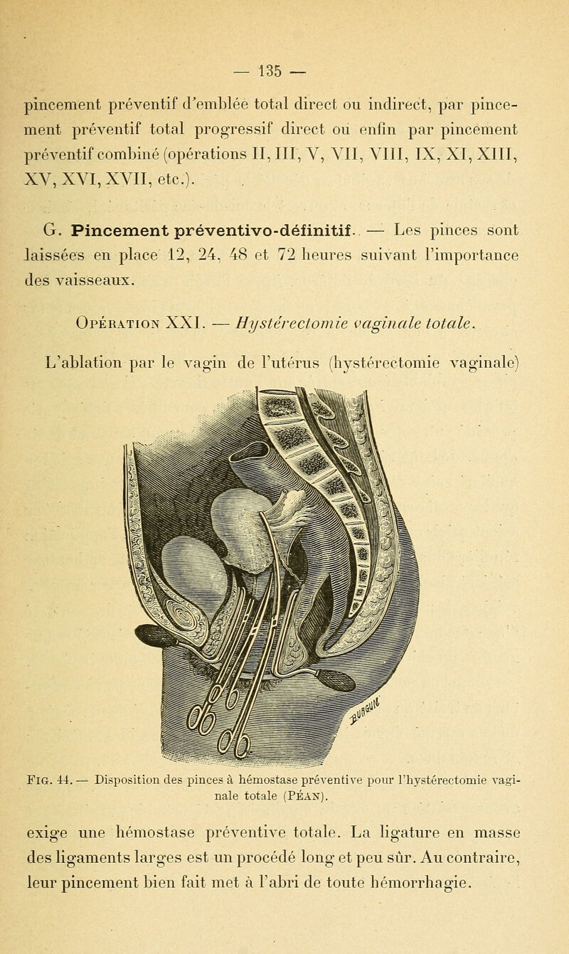 pincement préventif d'emblée total direct ou indirect, par pince- ment préventif total progressif direct ou enfin par pincement préventif combiné (opérations II, III, V, VII, VIII, IX, XI, XIII, XV, XVI, XVII, etc.). G. Pincement préventivo-définitif. — Les pinces sont laissées en place 12, 24, 48 et 72 heures suivant l'importance des vaisseaux. Opération XXI. — Hystéréotomie vaginale totale. L'ablation par le vagin de l'utérus (hystérectomie vaginale) FlG. 4-1. — Disposition des pinces à hémostase préventive pour l'hystérectomie vagi- nale totale (Péan). exige une hémostase préventive totale. La ligature en masse des ligaments larges est un procédé long et peu sûr. Au contraire, leur pincement bien fait met à l'abri de toute hémorrhagie.