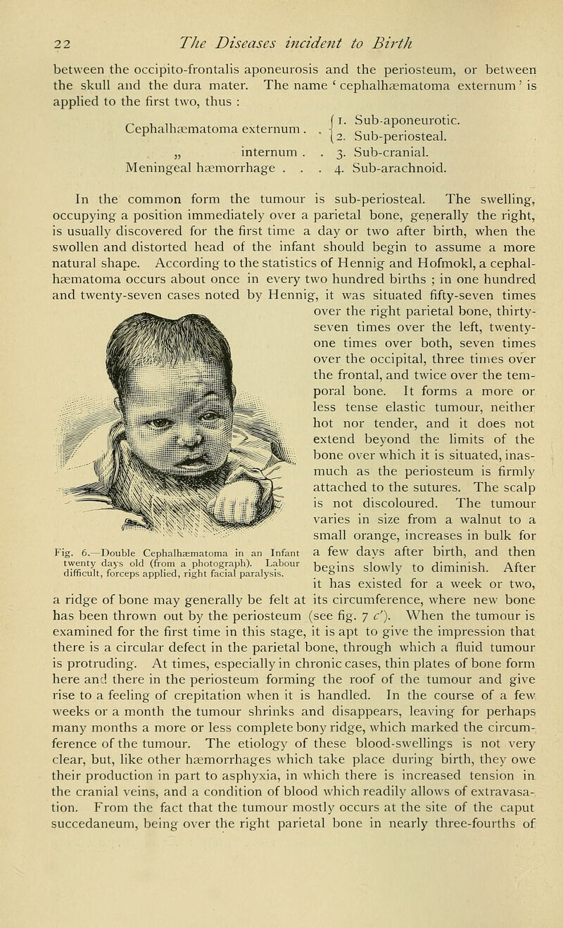between the occipito-frontalis aponeurosis and the periosteum, or between the skull and the dura mater. The name ' cephalhcematoma externum' is applied to the first two, thus : Cephalhaematoma externum. „ internum . Meningeal heemorrhage . . Sub-aponeurotic. Sub-periosteal. Sub-cranial. Sub-arachnoid. In the common form the tumour is sub-periosteal. The swelling, occupying a position immediately over a parietal bone, generally the right, is usually discovered for the first time a day or two after birth, when the swollen and distorted head of the infant should begin to assume a more natural shape. According to the statistics of Hennig and Hofmokl, a cephal- haematoma occurs about once in every two hundred births ; in one hundred and twenty-seven cases noted by Hennig, it was situated fifty-seven times over the right parietal bone, thirty- seven times over the left, twenty- one times over both, seven times over the occipital, three times over the frontal, and twice over the tem- poral bone. It forms a more or less tense elastic tumour, neither hot nor tender, and it does not extend beyond the limits of the bone over which it is situated, inas- much as the periosteum is firmly attached to the sutures. The scalp is not discoloured. The tumour varies in size from a walnut to a small orange, increases in bulk for a few days after birth, and then begins slowly to diminish. After it has existed for a week or two, Fig. 6.—Double Cephalhcematoma in an Infant twenty days old (from a photograph). Labour difficult, forceps applied, right facial paralysis. a ridge of bone may generally be felt at its circumference, where new bone has been thrown out by the periosteum (see fig. 7 c'). When the tumour is examined for the first time in this stage, it is apt to give the impression that there is a circular defect in the parietal bone, through which a fluid tumour is protruding. At times, especially in chronic cases, thin plates of bone form here and there in the periosteum forming the roof of the tumour and give rise to a feeling of crepitation when it is handled. In the course of a few weeks or a month the tumour shrinks and disappears, leaving for perhaps many months a more or less complete bony ridge, which marked the circum- ference of the tumour. The etiology of these blood-swellings is not very clear, but, like other haemorrhages which take place during birth, they owe their production in part to asphyxia, in which there is increased tension in the cranial veins, and a condition of blood which readily allows of extravasa- tion. From the fact that the tumour mostly occurs at the site of the caput succedaneum, being over the right parietal bone in nearly three-fourths of