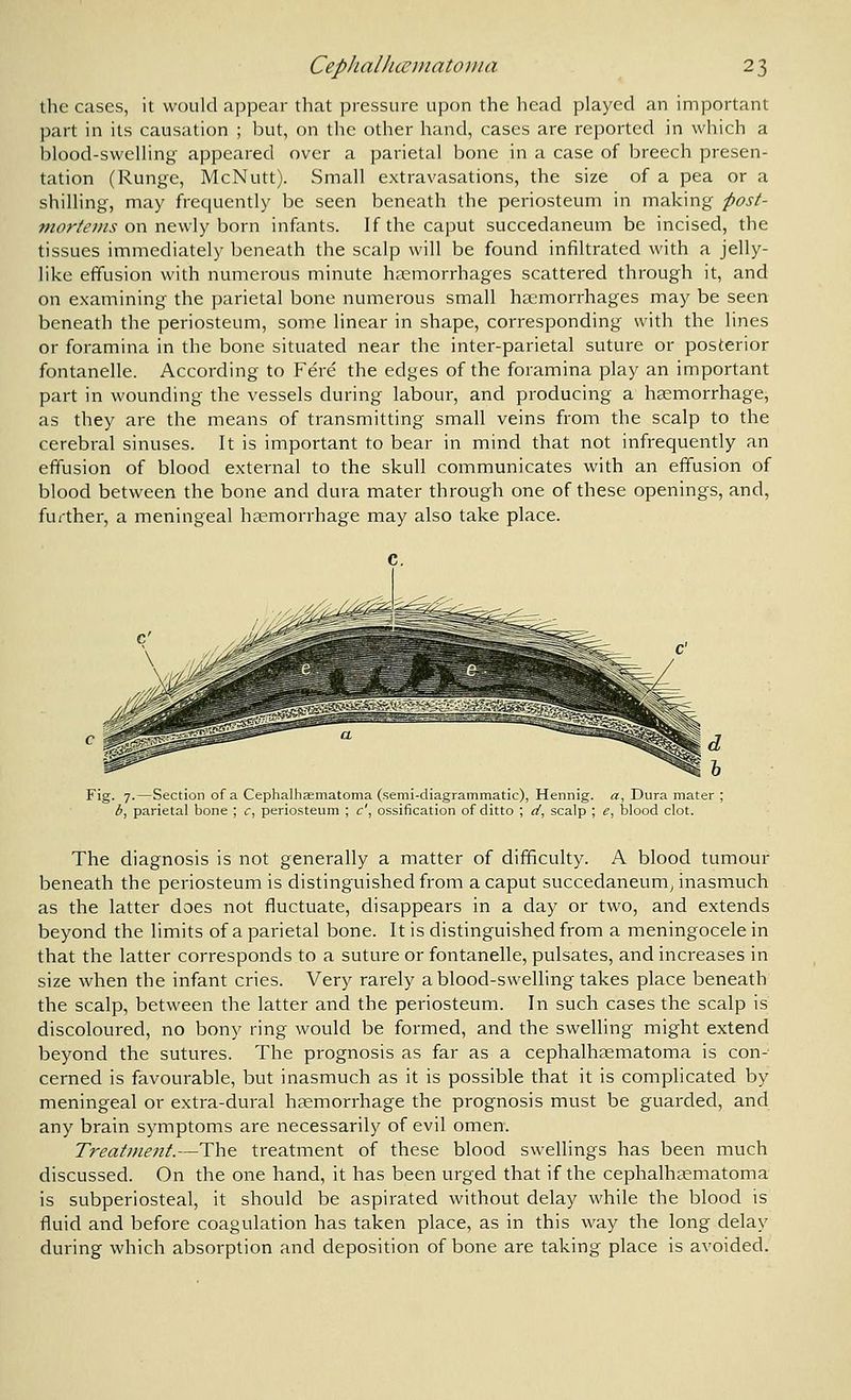the cases, it would appear that pressure upon the head played an important part in its causation ; but, on the other hand, cases are reported in which a ijlood-swelling appeared over a parietal bone in a case of breech presen- tation (Runge, McNutt). Small extravasations, the size of a pea or a shilling, may freciuently be seen beneath the periosteum in making post- mortems oxv n&\\\y horn infants. If the caput succedaneum be incised, the tissues immediately beneath the scalp will be found infiltrated with a jelly- like effusion with numerous minute haemorrhages scattered through it, and on examining the parietal bone numerous small haemorrhages may be seen beneath the periosteum, some linear in shape, corresponding with the lines or foramina in the bone situated near the inter-parietal suture or posterior fontanelle. According to Fere the edges of the foramina play an important part in wounding the vessels during labour, and producing a haemorrhage, as they are the means of transmitting small veins from the scalp to the cerebral sinuses. It is important to bear in mind that not infrequently an effusion of blood external to the skull communicates with an effusion of blood between the bone and dura mater through one of these openings, and, further, a meningeal haemorrhage may also take place. Fig. 7.—Section of a Cephalhaematoma (semi-diagrammatic), Hennig. a, Dura mater ; b, parietal bone ; c, periosteum ; c', ossification of ditto ; d, scalp ; e, blood clot. The diagnosis is not generally a matter of difficulty. A blood tumour beneath the periosteum is distinguished from a caput succedaneum^ inasmuch as the latter does not fluctuate, disappears in a day or two, and extends beyond the limits of a parietal bone. It is distinguished from a meningocele in that the latter corresponds to a suture or fontanelle, pulsates, and increases in size when the infant cries. Very rarely a blood-swelling takes place beneath the scalp, between the latter and the periosteum. In such cases the scalp is discoloured, no bony ring would be formed, and the swelling might extend beyond the sutures. The prognosis as far as a cephalhaematoma is con- cerned is favourable, but inasmuch as it is possible that it is complicated by meningeal or extra-dural haemorrhage the prognosis must be guarded, and any brain symptoms are necessarily of evil omen. Treatment.—The treatment of these blood swellings has been much discussed. On the one hand, it has been urged that if the cephalhematoma is subperiosteal, it should be aspirated without delay while the blood is fluid and before coagulation has taken place, as in this way the long delay during which absorption and deposition of bone are taking place is avoided.