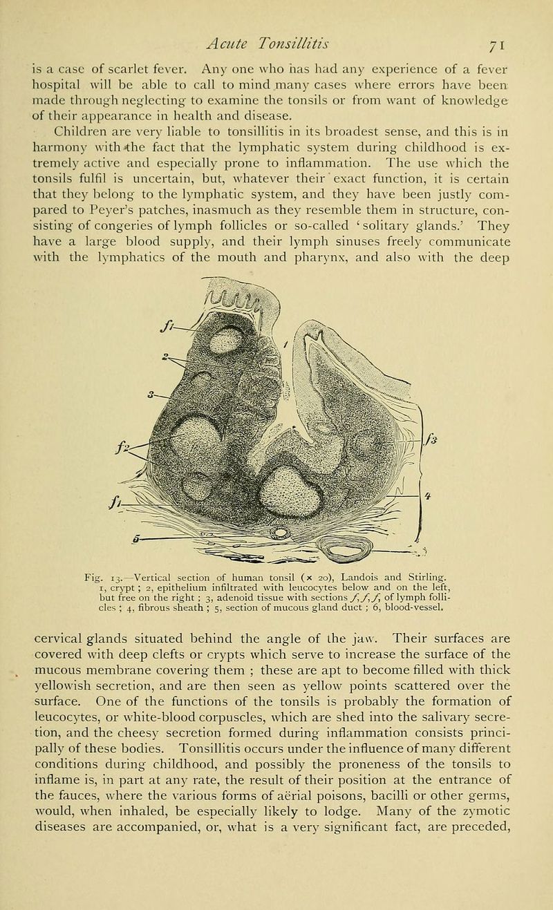 is a case of scarlet fe\er. Any one who has had any experience of a fever hospital will be able to call to mind many cases where errors have been made through neglecting to examine the tonsils or from want of knowledge of their appearance in health and disease. Children are very liable to tonsillitis in its broadest sense, and this is in harmony with>the fact that the lymphatic system during childhood is ex- tremely active and especially prone to inflammation. The use which the tonsils fulfil is uncertain, but, whatever their exact function, it is certain that they belong to the lymphatic system, and they have been justly com- pared to Peyer's patches, inasmuch as they I'esemble them in structure, con- sisting of congeries of lymph follicles or so-called 'solitary glands.' They have a large blood supply, and their lymph sinuses freely communicate with the lymphatics of the mouth and pharynx, and also with the deep g. 13. Vertical section of human tonsil (x 20), Landois and Stirling. I, cr^-pt ; 2, epithelium infiltrated with leucocj'tes below and on the left, but free on the right ; 3, adenoid tissue with sections _/J_/5_/^ of lymph folli- cles ; 4, fibrous sheath ; 5, section of mucous gland duct ; 6, blood-vessel. cervical glands situated behind the angle of the jaw. Their surfaces are covered with deep clefts or crypts which serve to increase the surface of the mucous membrane covering them ; these are apt to become filled with thick yellowish secretion, and are then seen as yellow points scattered over the surface. One of the functions of the tonsils is probably the formation of leucocytes, or white-blood corpuscles, which are shed into the salivary secre- tion, and the cheesy secretion formed during inflammation consists princi- pally of these bodies. Tonsillitis occurs under the influence of many different conditions during childhood, and possibly the proneness of the tonsils to inflame is, in part at any rate, the result of their position at the entrance of the fauces, where the various forms of aerial poisons, bacilli or other germs, would, when inhaled, be especially likely to lodge. Many of the zymotic diseases are accompanied, or, what is a very significant fact, are preceded.