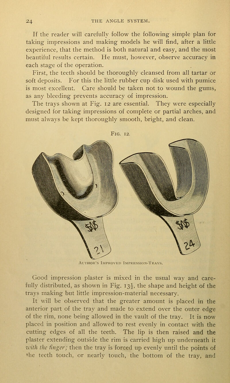 If the reader will carefully follow the following simple plan for taking impressions and making models he will find, after a little experience, that the method is both natural and easy, and the most beautiful results certain. He must, however, observe accuracy in each stage of the operation. First, the teeth should be thoroughly cleansed from all tartar or soft deposits. For this the little rubber cup disk used with pumice is most excellent. Care should be taken not to wound the gums, as any bleeding prevents accuracy of impression. The trays shown at Fig. 12 are essential. They were especially designed for taking impressions of complete or partial arches, and must always be kept thoroughly smooth, bright, and clean. Fig. 12. Author's Improved Impression-Travs. Good impression plaster is mixed in the usual way and care- fully distributed, as shown in Fig. I2,i, the shape and height of the trays making but little impression-material necessary. It will be observed that the greater amount is placed in the anterior part of the tray and made to extend over the outer edge of the rim, none being allowed in the vault of the tray. It is now placed in position and allowed to rest evenly in contact with the cutting edges of all the teeth. The lip is then raised and the plaster extending outside the rim is carried high up underneath it zvith the finger; then the tray is forced up evenly until the points of Hie teeth touch, or nearly touch, the bottom of the tray, and