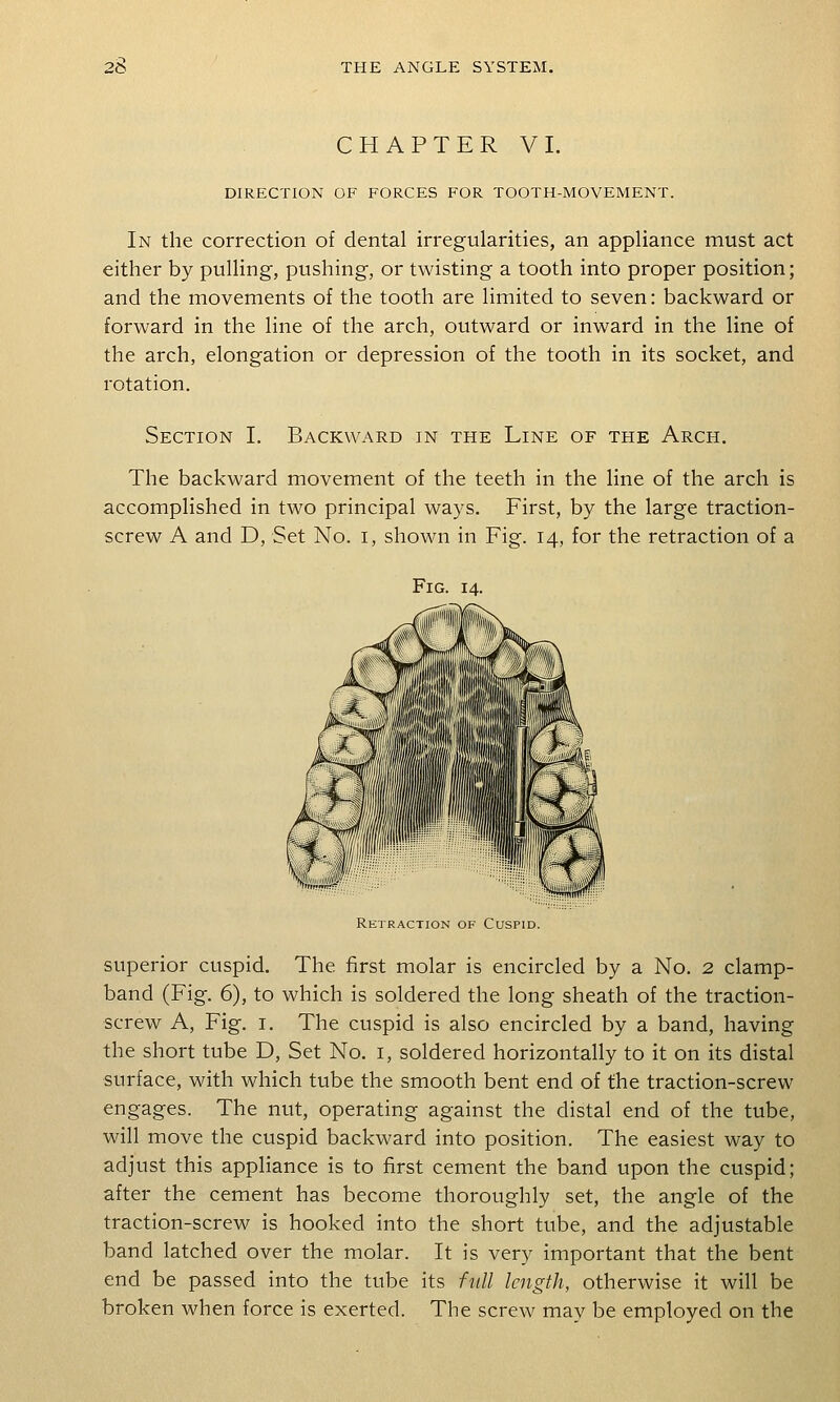 CHAPTER VI. DIRECTION OF FORCES FOR TOOTH-MOVEMENT. In the correction of dental irregularities, an appliance must act either by pulling, pushing, or twisting a tooth into proper position; and the movements of the tooth are limited to seven: backward or forward in the line of the arch, outward or inward in the line of the arch, elongation or depression of the tooth in its socket, and rotation. Section I. Backward in the Line of the Arch. The backward movement of the teeth in the line of the arch is accomplished in two principal ways. First, by the large traction- screw A and D, Set No. i, shown in Fig. 14, for the retraction of a Fig Retraction of Cuspid. superior cuspid. The first molar is encircled by a No. 2 clamp- band (Fig. 6), to which is soldered the long sheath of the traction- screw A, Fig. I. The cuspid is also encircled by a band, having the short tube D, Set No. i, soldered horizontally to it on its distal surface, with which tube the smooth bent end of the traction-screw engages. The nut, operating against the distal end of the tube, will move the cuspid backward into position. The easiest way to adjust this appliance is to first cement the band upon the cuspid; after the cement has become thoroughly set, the angle of the traction-screw is hooked into the short tube, and the adjustable band latched over the molar. It is very important that the bent end be passed into the tube its full length, otherwise it will be broken when force is exerted. The screw may be employed on the