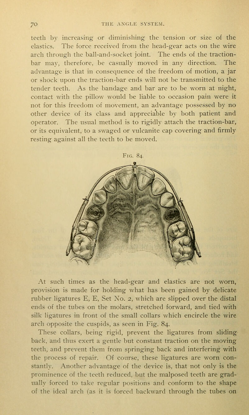 teeth by increasing or diminishing the tension or size of the elastics. The force received from the head-gear acts on the wire arch through the bah-and-socket joint. The ends of the traction- bar may, therefore, be casuahy moved in any direction. The advantage is that in consequence of the freedom of motion, a jar or shock upon the traction-bar ends will not be transmitted to the tender teeth. As the bandage and bar are to be worn at night, contact with the pillow would be liable to occasion pain were it not for this freedom of movement, an advantage possessed by no other device of its class and appreciable by both patient and operator. The usual method is to rigidly attach the traction-bar, or its equivalent, to a swaged or vulcanite cap covering and firmly resting- aeainst all the teeth to be moved. Fig. 84. At such times as the head-gear and elastics are not worn, provision is made for holding what has been gained by delicate rubber ligatures E, E, Set No. 2, which are slipped over the distal ends of the tubes on the molars, stretched forward, and tied with silk ligatures in front of the small collars which encircle the wire arch opposite the cuspids, as seen in Fig. 84. These collars, being rigid, prevent the ligatures from sliding back, and thus exert a gentle but constant traction on the moving teeth, and prevent them from springing back and interfering with the process of repair. Of course, these ligatures are worn con- stantly. Another advantage of the device is, that not only is the prominence of the teeth reduced, but the malposed teeth are grad- ually forced to take regular positions and conform to the shape of the ideal arch (as it is forced backward through the tubes on