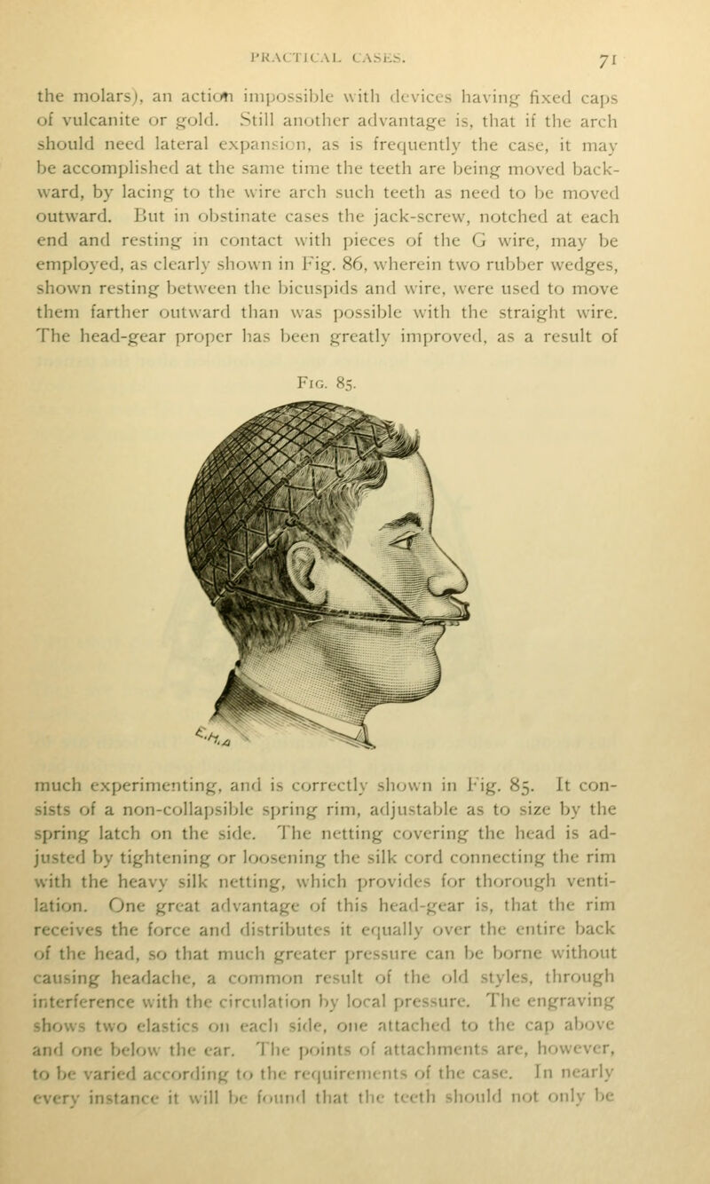 7^ the molarsj, an actioti iniixjssiljlc with devices havinj,'- fixed caps of vulcanite or gold. Still another advantage is, that if the arch should need lateral expansion, as is frequently the case, it may be accomplished at the same time the teeth are being moved back- ward, by lacing to the wire arch such teeth as need to be moved outward. But in obstinate cases the jack-screw, notched at each end and resting in contact with pieces of the G wire, may be employed, as clearly shown in Fig. 86, wherein two rubber wedges, shown resting between the bicuspids and wire, were used to move them farther outward than was possible with the straight wire. The head-gear projjcr has l)een greatly inijjroved, as a result of Fin. 85. much experimenting, and is correctly shown in Fig. 85. It con- sists of a non-collapsible sjjring rim, adjustable as to size by the spring latch on the side. The netting covering the head is ad- justed by tightening or loosening the silk cord connecting the rim with the heavy silk netting, which provides for thorough venti- lation. One great advantage of this head-gear is, that the rim receives the force and distributes it equally over the entire back of the head, so that much greater pressure can be borne without causing headache, a comnif>n result of the old styles, through interference with the circulation by local pressure. The engraving -hows two elastics on each side, one attached to the cap above and one belmv the ear. The points of attachments are, however, to be varied according to the requirements of the case. In nearly 'verv instance it will be found that the teeth should not only be
