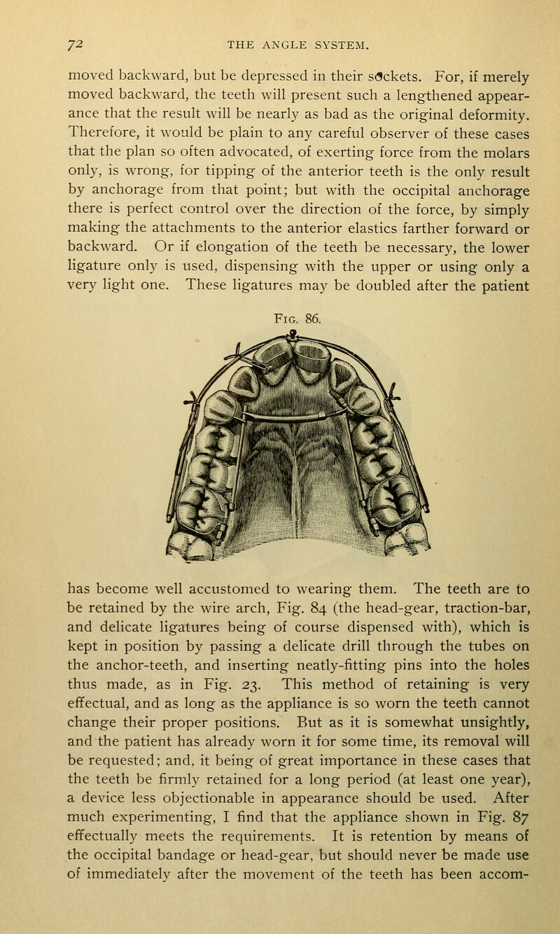 moved backward, but be depressed in their s(5ckets. For, if merely moved backward, the teeth will present such a lengthened appear- ance that the result will be nearly as bad as the original deformity. Therefore, it would be plain to any careful observer of these cases that the plan so often advocated, of exerting force from the molars only, is wrong, for tipping of the anterior teeth is the only result by anchorage from that point; but with the occipital anchorage there is perfect control over the direction of the force, by simply making the attachments to the anterior elastics farther forward or backward. Or if elongation of the teeth be necessary, the lower ligature only is used, dispensing with the upper or using only a very light one. These ligatures may be doubled after the patient Fig. 86. has become well accustomed to wearing them. The teeth are to be retained by the wire arch. Fig. 84 (the head-gear, traction-bar, and delicate ligatures being of course dispensed with), which is kept in position by passing a delicate drill through the tubes on the anchor-teeth, and inserting neatly-fitting pins into the holes thus made, as in Fig. 23. This method of retaining is very efifectual, and as long as the appliance is so worn the teeth cannot change their proper positions. But as it is somewhat unsightly, and the patient has already worn it for some time, its removal will be requested; and, it being of great importance in these cases that the teeth be firmly retained for a long period (at least one year), a device less objectionable in appearance should be used. After much experimenting, I find that the appliance shown in Fig. 87 effectually meets the requirements. It is retention by means of the occipital bandage or head-gear, but should never be made use of immediately after the movement of the teeth has been accom-