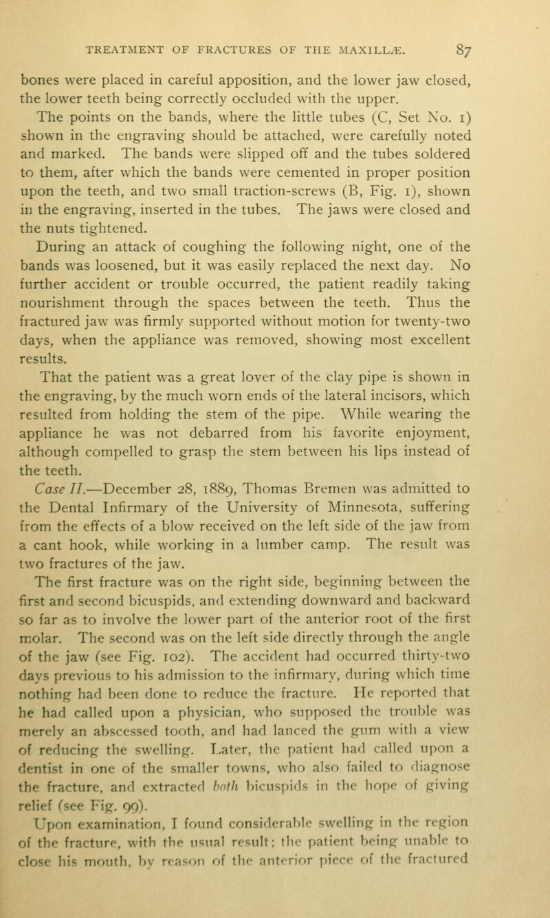 bones were placed in careful apposition, and the lower jaw closed, the lower teeth being correctly occluded with the upper. The points on the bands, where the little tubes (C, Set No. i) shown in the engraving should be attached, were carefully noted and marked. The bands were slipped ofif and the tubes soldered to them, after which the bands were cemented in proper position upon the teeth, and two small traction-screws (B, Fig. i), shown in the engraving, inserted in the tubes. The jaws were closed and the nuts tightened. During an attack of coughing the following night, one of the bands was loosened, but it was easily replaced the next day. No further accident or trouble occurred, the patient readily taking nourishment through the spaces between the teeth. Thus the fractured jaw was firmly supported without motion for twenty-two days, when the appliance was removed, showing most excellent results. That the patient was a great lover of the clay pipe is shown in the engraving, by the much worn ends of the lateral incisors, which resulted from holding the stem of the pipe. While wearing the appliance he was not debarred from his favorite enjoyment, although compelled to grasp the stem between his lips instead of the teeth. Case II.—December 28, 1889, Thomas Bremen was admitted to the Dental Infirmary of the University of Minnesota, suffering from the efifects of a blow received on the left side of the jaw from a cant hook, while working in a lumber camp. The result was two fractures of the jaw. The first fracture was on the right side, beginning between the first and second bicuspids, and extending downward and backward so far as to involve the lower part of the anterior root of the first molar. The second was on the left side directly through the angle of the jaw (see Fig. 102). The accident had occurred thirty-two days previous to his admission to the infirmary, during which time nothing had been done to reduce the fracture. He reported that he had called upon a physician, who supposed the trouble was merely an abscessed tooth, and had lanced the gum with a view of reducing the swelling. Later, the patient had called upon a dentist in one of the smaller towns, who also failed to diagnose the fracture, and extracted hnth bicuspids in the hope of giving relief Csee Fig. 99). Upon examination, T found considerable swelling in the region of the fracture, with the usual result; the patient being unable to close his mouth, bv reason of the anterior piece of the fractured