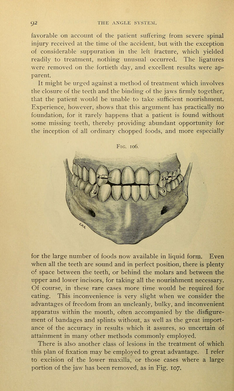 favorable on account of the patient suffering from severe spinal injury received at the time of the accident, but with the exception of considerable suppuration in the left fracture, which yielded readily to treatment, nothing unusual occurred. The ligatures were removed on the fortieth day, and excellent results were ap- parent. It might be urged against a method of treatment which involves the closure of the teeth and the binding of the jaws firmly together, that the patient would be unable to take sufficient nourishment. Experience, however, shows that this argument has practically no foundation, for it rarely happens that a patient is found without some missing teeth, thereby providing abundant opportunity for the inception of all ordinary chopped foods, and more especially Fig. io6. for the large number of foods now available in liquid form. Even when all the teeth are sound and in perfect position, there is plenty of space between the teeth, or behind the molars and between the upper and lower incisors, for taking all the nourishment necessary. Of course, in these rare cases more time would be required for eating. This inconvenience is very slight when we consider the advantages of freedom from an uncleanly, bulky, and inconvenient apparatus within the mouth, often accompanied by the disfigure- ment of bandages and splints without, as well as the great import- ance of the accuracy in results which it assures, so uncertain of attainment in many other methods commonly employed. There is also another class of lesions in the treatment of which this plan of fixation may be employed to great advantage. I refer to excision of the lower maxilla, or those cases where a large portion of the jaw has been removed, as in Fig, 107,