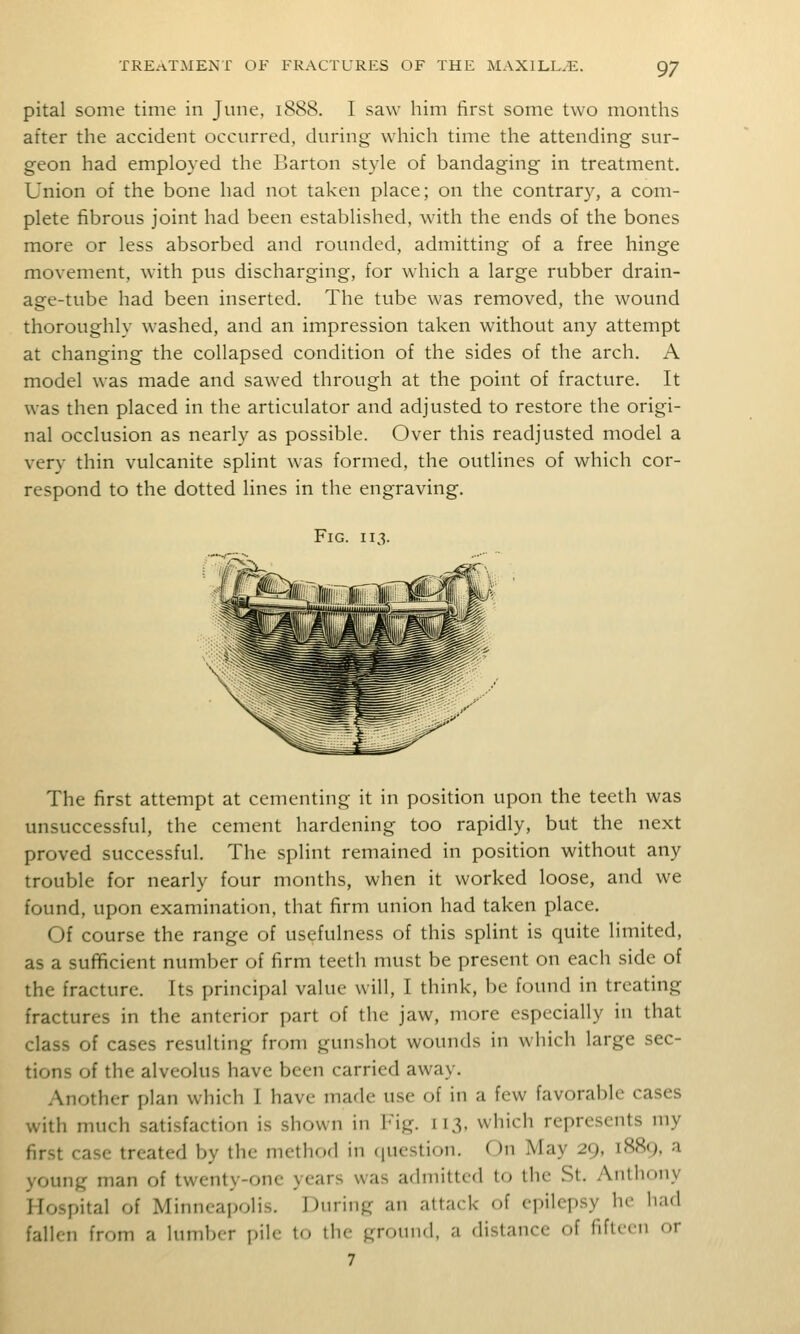 pital some time in June, 1888. I saw him first some two months after the accident occurred, during which time the attending sur- geon had employed the Barton style of bandaging in treatment. Union of the bone had not taken place; on the contrary, a com- plete fibrous joint had been established, with the ends of the bones more or less absorbed and rounded, admitting of a free hinge movement, with pus discharging, for which a large rubber drain- age-tube had been inserted. The tube was removed, the wound thoroughly washed, and an impression taken without any attempt at changing the collapsed condition of the sides of the arch. A model was made and sawed through at the point of fracture. It was then placed in the articulator and adjusted to restore the origi- nal occlusion as nearly as possible. Over this readjusted model a very thin vulcanite splint was formed, the outlines of which cor- respond to the dotted lines in the engraving. Fig. 113. The first attempt at cementing it in position upon the teeth was unsuccessful, the cement hardening too rapidly, but the next proved successful. The splint remained in position without any trouble for nearly four months, when it worked loose, and we found, upon examination, that firm union had taken place. Of course the range of usefulness of this splint is quite limited, as a sufficient number of firm teeth must be present on each side of the fracture. Its principal value will, I think, be found in treating fractures in the anterior part of the jaw, more especially in that class of cases resulting from gunshot wounds in which large sec- tions of the alveolus have been carried away. Another plan which I have made use of in a few favorable cases with much satisfaction is shown in Fig. 113, which represents my first case treated by the method in (juestion. On May 29, 1889, a young man of twenty-one years was admitted to the St. Anthony Hospital of Minncai)olis. During an attack of epilepsy he had fallen from a lumber pile to the groniul, a distance of fifteen or 7