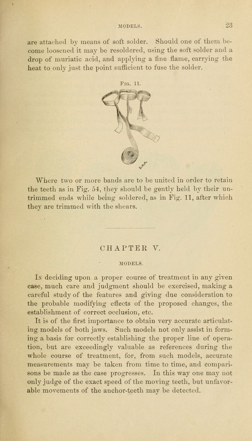 are attached by means of soft solder. Should one of them be- come loosened it may be resoldered, using the soft solder and a drop of muriatic acid, and applying a fine flame, carrying the heat to only Just the point suflicient to fuse the solder. Where two or more bands are to be united in order to retain the teeth as in Fig. 54, they should be gently held by their un- trimmed ends while being soldered, as in Fig. 11, after which they are trimmed with the shears. CHAPTER V. MODELS. In deciding upon a proper course of treatment in any giyen case, much care and judgment should be exercised, making a careful study of the features and giving due consideration to the probable modifying effects of the proposed changes, the establishment of correct occlusion, etc. It is of the first importance to obtain yery accurate articulat- ing models of both jaws. Such models not only assist in form- ing a basis for correctly establishing the proper line of opei-a- tion, but are exceedingly valuable as references during the whole course of treatment, for, from such models, accurate measurements may be taken from time to time, and compari- sons be made as the case progresses. In this way one may not only judge of the exact speed of the moving teeth, but unfavor- able movements of the anchor-teeth mav be detected.