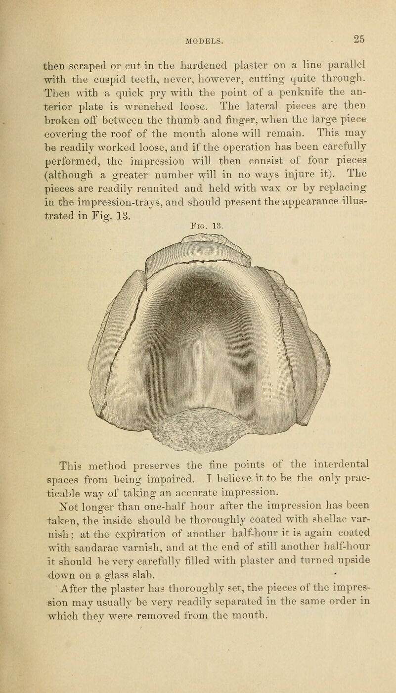 then scraped or cut in the hardened plaster on a line parallel with the cuspid teeth, never, however, cutting quite through. Then \^■ith a quick pry with the point of a penknife the an- terior plate is wrenched loose. The lateral pieces are then broken off between the thumb and finger, when the large piece covering the roof of the mouth alone will remain. This may be readily worked loose, and if the operation has been carefully performed, the impression will then consist of four pieces (although a greater number will in no ways injure it). The pieces are readily reunited and held with wax or by replacing in the impression-trays, and should present the appearance illus- trated in Fig. 13. Fig. 13. \ ^ This method preserves the fine points of the interdental spaces from being impaired. I believe it to be the only prac- ticable way of taking an accurate impression. Not longer than one-half hour after the impression has been taken, the inside should be thoroughly coated with shellac var- nish ; at the expiration of another half-hour it is again coated with sandarac varnish, and at the end of still another half-hour it should be very carefully filled with plaster and turned upside down on a glass slab. After the plaster has thoroughly set, the pieces of the impres- sion may usually be very readily separated in the same order in which they were removed from the mouth.