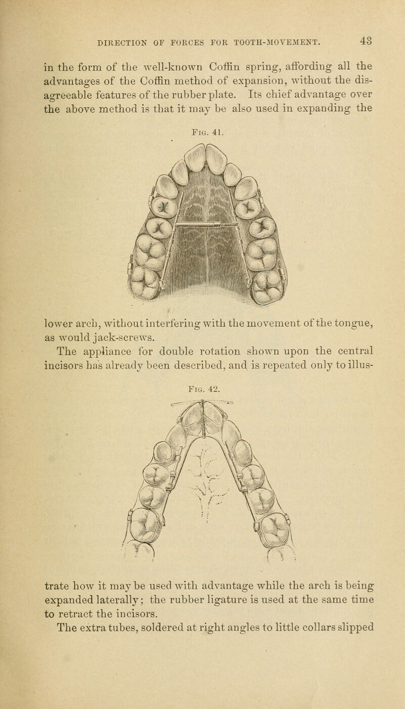 in the form of the well-known Coffin spring, affording all the advantages of the Coffin method of expansion, without the dis- agreeable features of the rubber plate. Its chief advantage over the above method is that it may be also used in expanding the Fig. 41. piiaiili lower arch, without interfering with the movement of the tongue, as would jack-serev\'s. The appliance for double rotation shown upon the central incisors has already been described, and is repeated only to illus- FiG. 42. trate how it may be used with advantage while the arch is being expanded laterally; the rubber ligature is used at the same time to retract the incisors. The extra tubes, soldered at right angles to little collars slipped