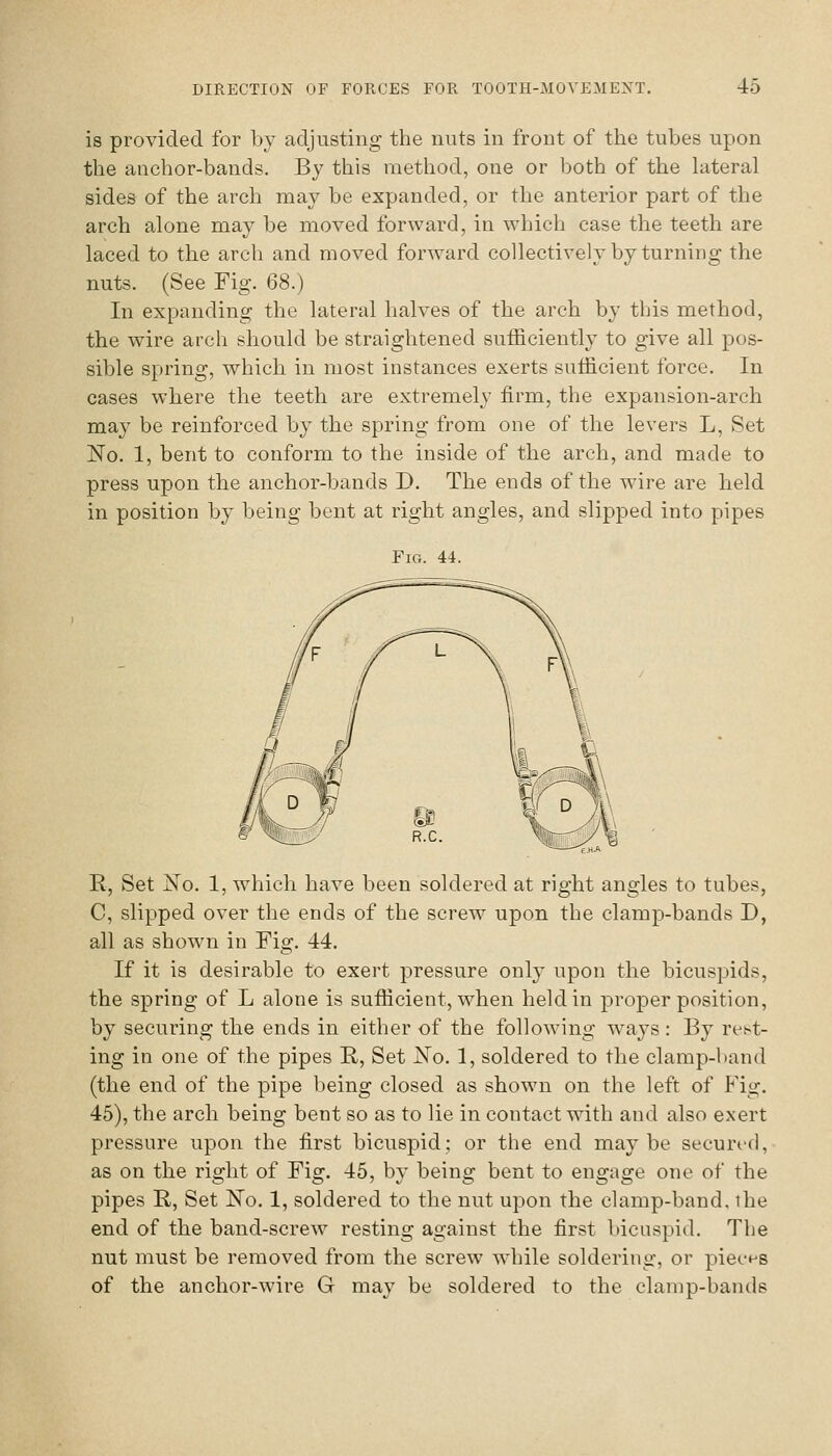 is provided for by adjusting the nuts in front of the tubes upon the anchor-bands. By this method, one or both of the lateral sides of the arch may be expanded, or the anterior part of the arch alone may be moved forward, in which case the teeth are laced to the arch and moved forward collectively by turning the nuts. (See Fig. 68.) In expanding the lateral halves of the arch by this method, the wire arch should be straightened sufficiently to give all pos- sible spring, which in most instances exerts sufficient force. In cases where the teeth are extremely firm, the expansion-arch may be reinforced by the spring from one of the levers L, Set No. 1, bent to conform to the inside of the arch, and made to press upon the anchor-bands D. The ends of the wire are held in position by being bent at right angles, and slipped into pipes Fig. 44. R, Set xTo. 1, which have been soldered at right angles to tubes, C, slipped over the ends of the screw upon the clamp-bands D, all as shown in Fig. 44. If it is desirable to exert pressure only upon the bicuspids, the spring of L alone is sufficient, when held in proper position, by securing the ends in either of the following w^ays: By rest- ing in one of the pipes R, Set JNo. 1, soldered to the clamp-band (the end of the pipe being closed as shown on the left of Fig. 45), the arch being bent so as to lie in contact with and also exert pressure upon the first bicuspid; or the end maybe secun-ci, as on the right of Fig. 45, by being bent to engage one of the pipes R, Set jSTo. 1, soldered to the nut upon the clamp-band, the end of the band-screw resting against the first bicuspid. The nut must be removed from the screw wdnle soldering, or piec-ns of the anchor-wire G may be soldered to the clamp-bands