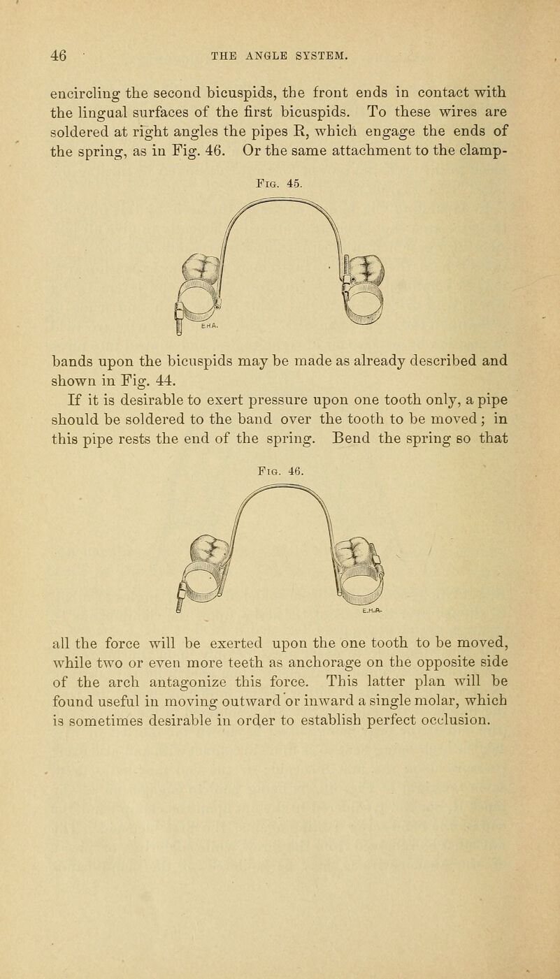 encircling the second bicuspids, the front ends in contact with the lingaal surfaces of the first bicuspids. To these wires are soldered at right angles the pipes R, which engage the ends of the spring, as in Fig. 46. Or the same attachment to the clamp- FiG. 45. bands upon the bicuspids may be made as already described and shown in Fig. 44. If it is desirable to exert pressure upon one tooth only, a pipe should be soldered to the band over the tooth to be moved ; in this pipe rests the end of the spring. Bend the spring so that Fig. 46. all the force will be exerted upon the one tooth to be moved, while two or even more teeth as anchorage on the opposite side of the arch antagonize this force. This latter plan will be found useful in moving outward or inward a single molar, which is sometimes desirable in order to establish perfect occlusion.