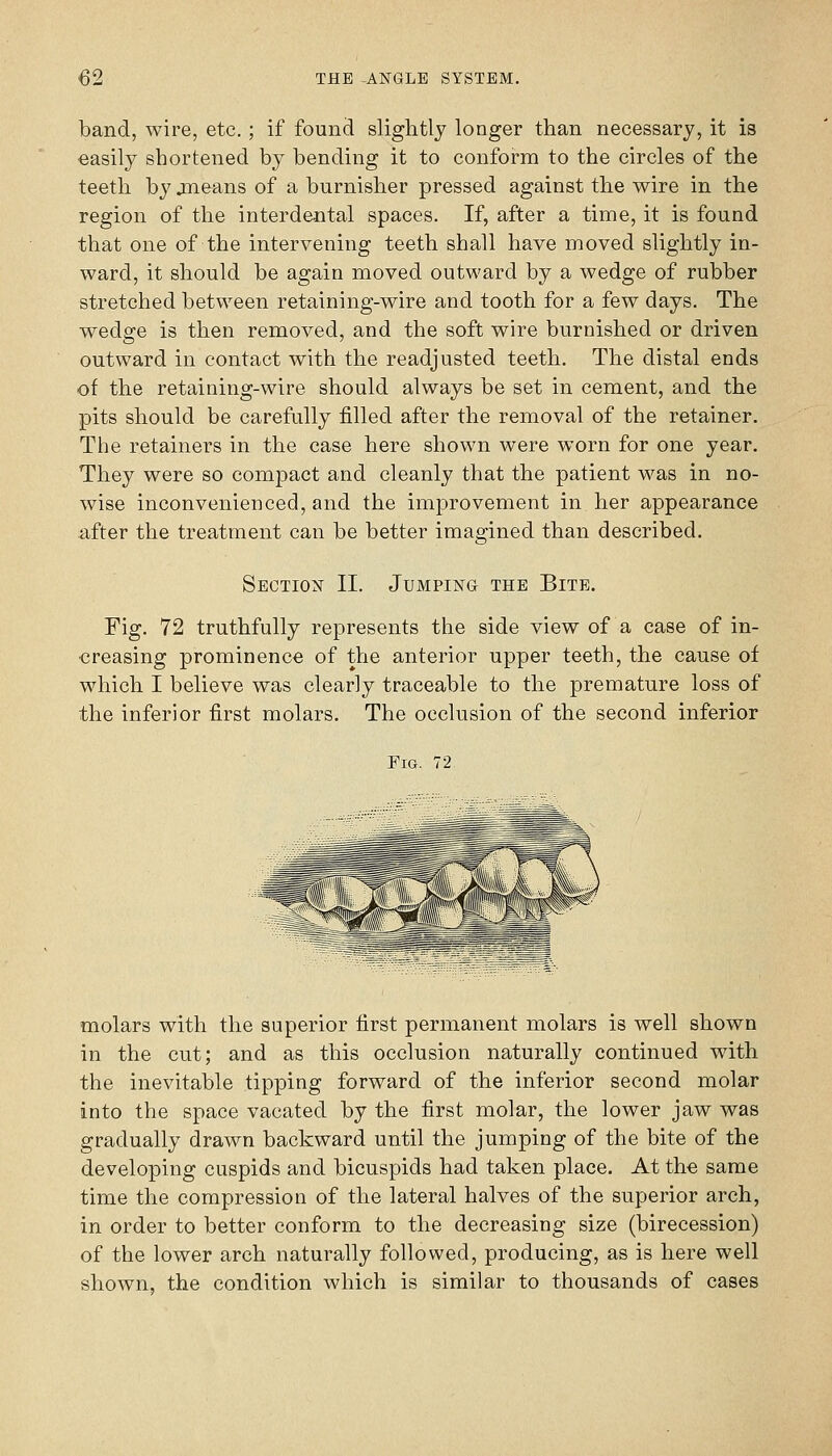band, wire, etc.; if found slightly longer than necessary, it is easily shortened by bending it to conform to the circles of the teeth by jneans of a burnisher pressed against the wire in the region of the interdental spaces. If, after a time, it is found that one of the intervening teeth shall have moved slightly in- ward, it should be again moved outward by a wedge of rubber stretched between retaining-wire and tooth for a few days. The wedge is then removed, and the soft wire burnished or driven outward in contact with the readjusted teeth. The distal ends of the retaining-wire should always be set in cement, and the pits should be carefully filled after the removal of the retainer. The retainers in the case here shown were worn for one year. They were so compact and cleanly that the patient was in no- wise inconvenienced, and the imj)rovement in her appearance after the treatment can be better imagined than described. Section II. Jumping the Bite. Fig. 72 truthfully represents the side view of a case of in- creasing prominence of the anterior upper teeth, the cause of which I believe was clearly traceable to the premature loss of the inferior first molars. The occlusion of the second inferior Fig. 72 molars with the superior first permanent molars is well shown in the cut; and as this occlusion naturally continued with the inevitable tipping forward of the inferior second molar into the space vacated by the first molar, the lower jaw was gradually drawn backward until the jumping of the bite of the developing cuspids and bicuspids had taken place. At the same time the compression of the lateral halves of the superior arch, in order to better conform to the decreasing size (birecession) of the lower arch naturally followed, producing, as is here well shown, the condition which is similar to thousands of cases