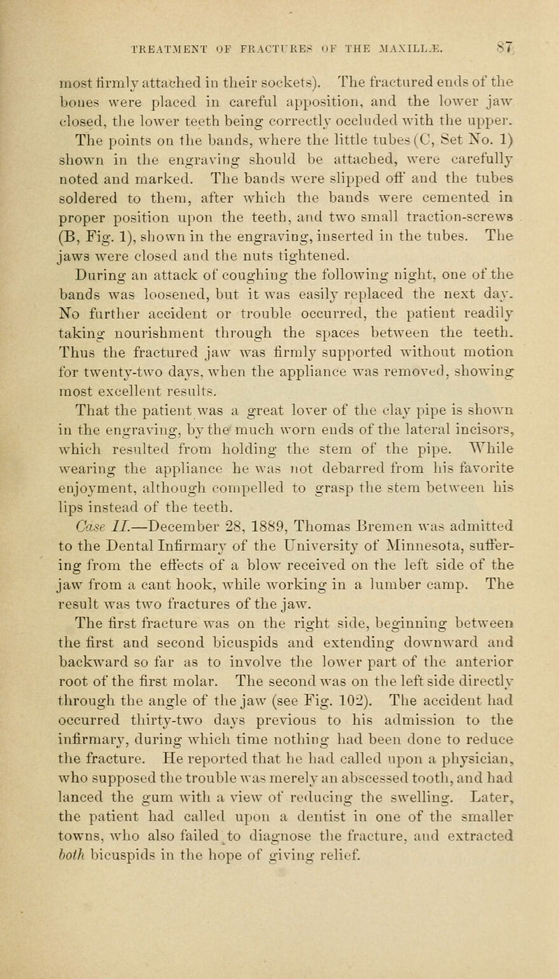 most tirmly attached in their sockets). The fractured ends of the bones were placed in careful apposition, and the lower jaw- closed, the lower teeth being correctly occluded with the upper. The points on the bands, where the little tubes (C, Set No. 1) shown in the engraving should be attached, were carefully noted and marked. The bands were slipped off and the tubes soldered to them, after which the bands were cemented in proper position upon the teeth, and two small traction-screws (B, Fig. 1), shown in the engraving, inserted in the tubes. The jaws were closed and the nuts tightened. During an attack of coughing the following night, one of the bands was loosened, but it was easily replaced the next day. No further accident or trouble occurred, the patient readily taking nourishment through the spaces between the teeth. Thus the fractured jaw was firmly supported without motion for twenty-two days, when the appliance was removed, showing most excellent results. That the patient was a great lover of the clay pipe is shown in the engraving, bythefmuch worn ends of the lateral incisors, which resulted from holding the stem of the pipe. While wearing the appliance he was not debarred from his favorite enjoyment, although compelled to grasp the stem between his lips instead of the teeth. Case II.—December 28, 1889, Thomas Bremen was admitted to the Dental Infirmary of the University of Minnesota, suffer- ing from the effects of a blow received on the left side of the jaw from a cant hook, while working in a lumber camp. The result was two fractures of the jaw. The first fracture was on the right side, beginning between the first and second bicuspids and extending downward and backw^ard so far as to involve the lower part of the anterior root of the first molar. The second was on the leftside directly through the angle of the jaw (see Fig. 102). The accident had occurred thirty-two days previous to his admission to the infirmary, durino- which time nothins: had been done to reduce the fracture. He reported that he had called upon a physician, who supposed the trouble was merely an abscessed tooth, and had lanced the gum with a view of reducing the swelling. Later, the patient had called upon a dentist in one of the smaller towns, who also failed to diagnose the fracture, and extracted both bicuspids in the hope of giving relief.