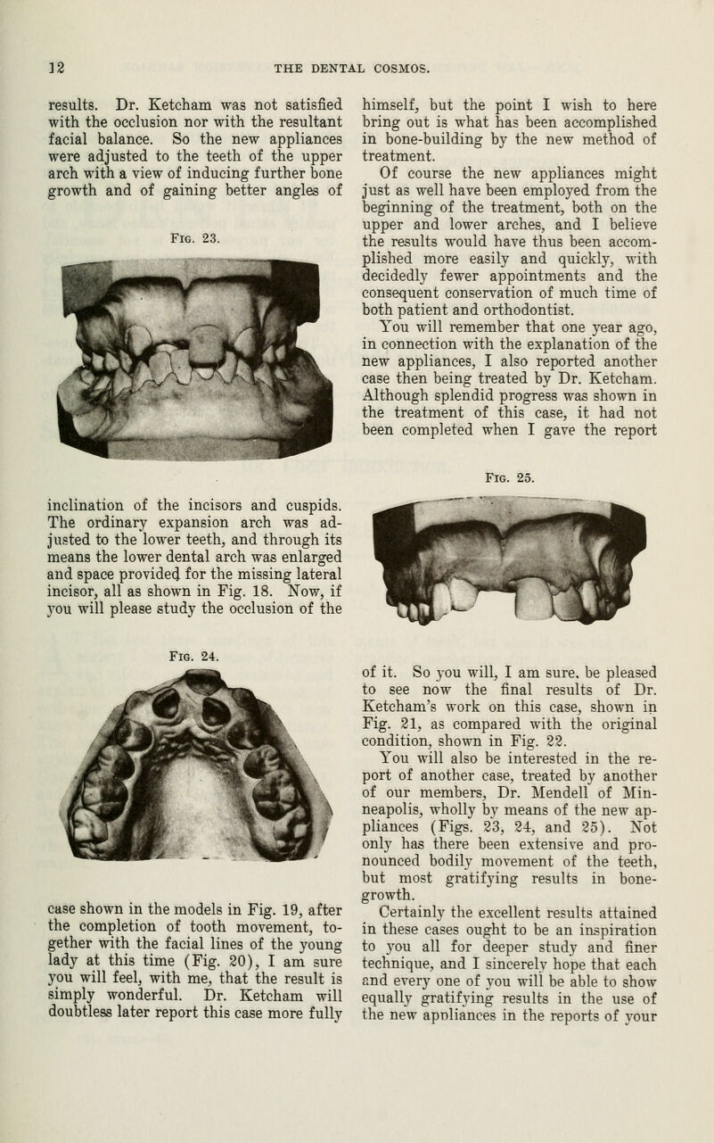 results. Dr. Ketcham was not satisfied with the occlusion nor with the resultant facial balance. So the new appliances were adjusted to the teeth of the upper arch with a view of inducing further bone growth and of gaining better angles of Fig. 23. inclination of the incisors and cuspids. The ordinary expansion arch was ad- justed to the lower teeth, and through its means the lower dental arch was enlarged and space provide^ for the missing lateral incisor, all as shown in Fig. 18. Now, if 3'-ou will please study the occlusion of the himself, but the point I wish to here bring out is what has been accomplished in bone-building by the new method of treatment. Of course the new appliances might just as well have been employed from the beginning of the treatment, both on the upper and lower arches, and I believe the results would have thus been accom- plished more easily and quickly, with decidedly fewer appointments and the consequent conservation of much time of both patient and orthodontist. You will remember that one year ago, in connection with the explanation of the new appliances, I also reported another case then being treated by Dr. Ketcham. Although splendid progress was shown in the treatment of this case, it had not been completed when I gave the report Fig. 25. Fig. 24. case shown in the models in Fig. 19, after the completion of tooth movement, to- gether with the facial lines of the young lady at this time (Fig. 20), I am sure you will feel, with me, that the result is simply wonderful. Dr. Ketcham will doubtless later report this case more fullv of it. So you will, I am sure, be pleased to see now the final results of Dr. Ketcham's work on this case, shown in Fig. 21, as compared with the original condition, shown in Fig. 22. You will also be interested in the re- port of another case, treated by another of our members. Dr. Mendell of Min- neapolis, wholly bv means of the new ap- pliances (Figs. 23, 24, and 25). Not only has there been extensive and pro- nounced bodily movement of the teeth, but most gratifying results in bone- growth. Certainly the excellent results attained in these cases ought to be an inspiration to you all for deeper study and finer technique, and I sincerely hope that each and every one of you will be able to show equally gratifying results in the use of the new appliances in the reports of your