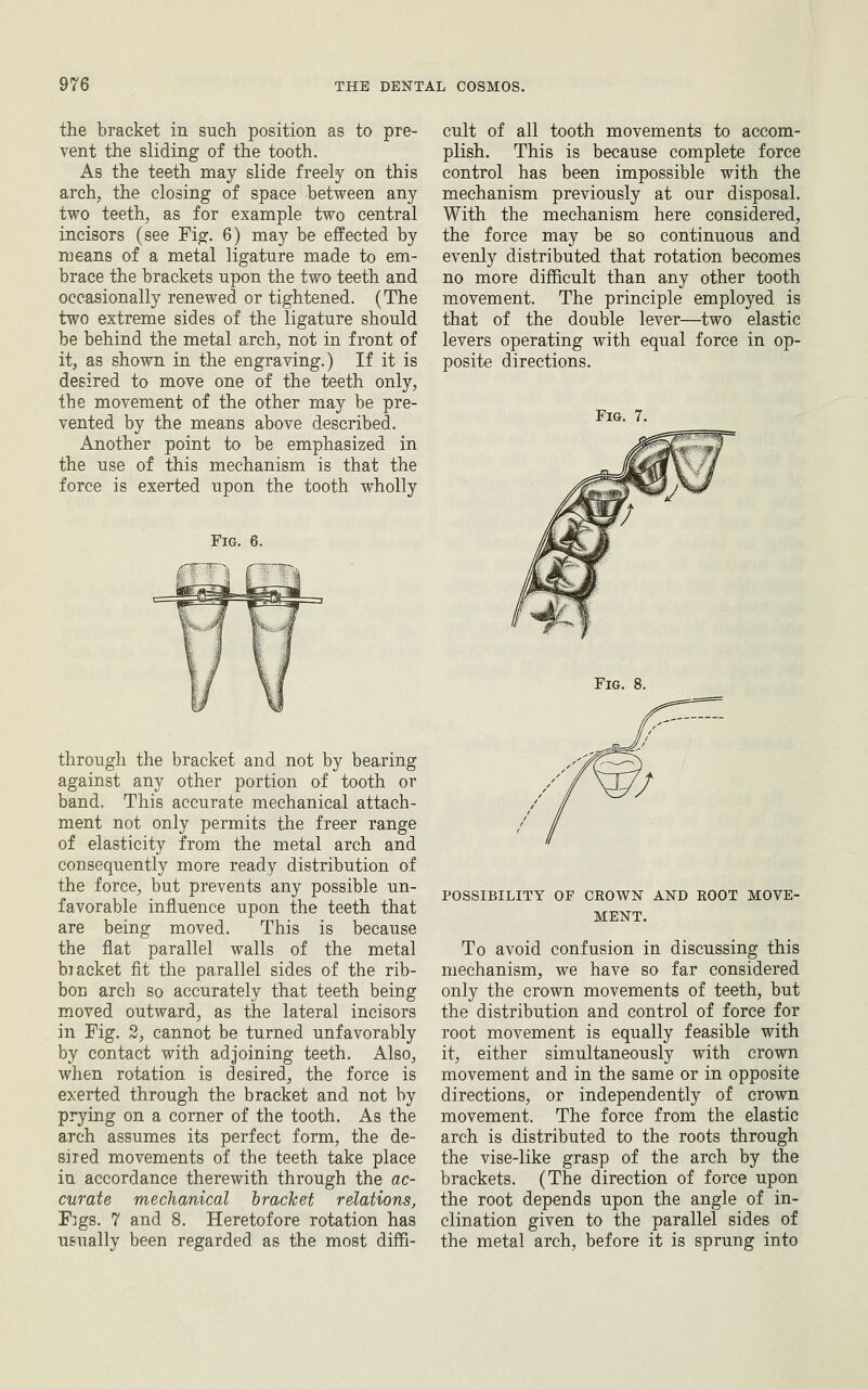 the bracket in such position as to pre- vent the sliding of the tooth. As the teeth may slide freely on this arch, the closing of space between any two teeth, as for example two central incisors (see Fig. 6) may be effected by means of a metal ligature made to em- brace the brackets upon the two teeth and occasionally renewed or tightened. (The two extreme sides of the ligature should be behind the metal arch, not in front of it, as shown in the engraving.) If it is desired to move one of the teeth only, the movement of the other may be pre- vented by the means above described. Another point to be emphasized in the use of this mechanism is that the force is exerted upon the tooth wholly Fig. 6. through the bracket and not by bearing against any other portion of tooth or band. This accurate mechanical attach- ment not only permits the freer range of elasticity from the metal arch and consequently more ready distribution of the force, but prevents any possible un- favorable influence upon the teeth that are being moved. This is because the flat parallel walls of the metal hiacket fit the parallel sides of the rib- bon arch so accurately that teeth being moved outward, as the lateral incisors in Fig. 2, cannot be turned unfavorably by contact with adjoining teeth. Also, when rotation is desired, the force is exerted through the bracket and not by prying on a comer of the tooth. As the arch assumes its perfect form, the de- sired movements of the teeth take place in accordance therewith through the ac- curate mechanical bracket relations, 'Figs. 7 and 8. Heretofore rotation has usually been regarded as the most diffi- cult of all tooth movements to accom- plish. This is because complete force control has been impossible with the mechanism previously at our disposal. With the mechanism here considered, the force may be so continuous and evenly distributed that rotation becomes no more difficult than any other tooth movement. The principle employed is that of the double lever—two elastic levers operating with equal force in op- posite directions. Fig. 7. Fig. 8. POSSIBILITY OF CROWN AND ROOT MOVE- MENT. To avoid confusion in discussing this mechanism, we have so far considered only the crown movements of teeth, but the distribution and control of force for root movement is equally feasible with it, either simultaneously with crown movement and in the same or in opposite directions, or independently of crown movement. The force from the elastic arch is distributed to the roots through the vise-like grasp of the arch by the brackets. (The direction of force upon the root depends upon the angle of in- clination given to the parallel sides of the metal arch, before it is sprung into