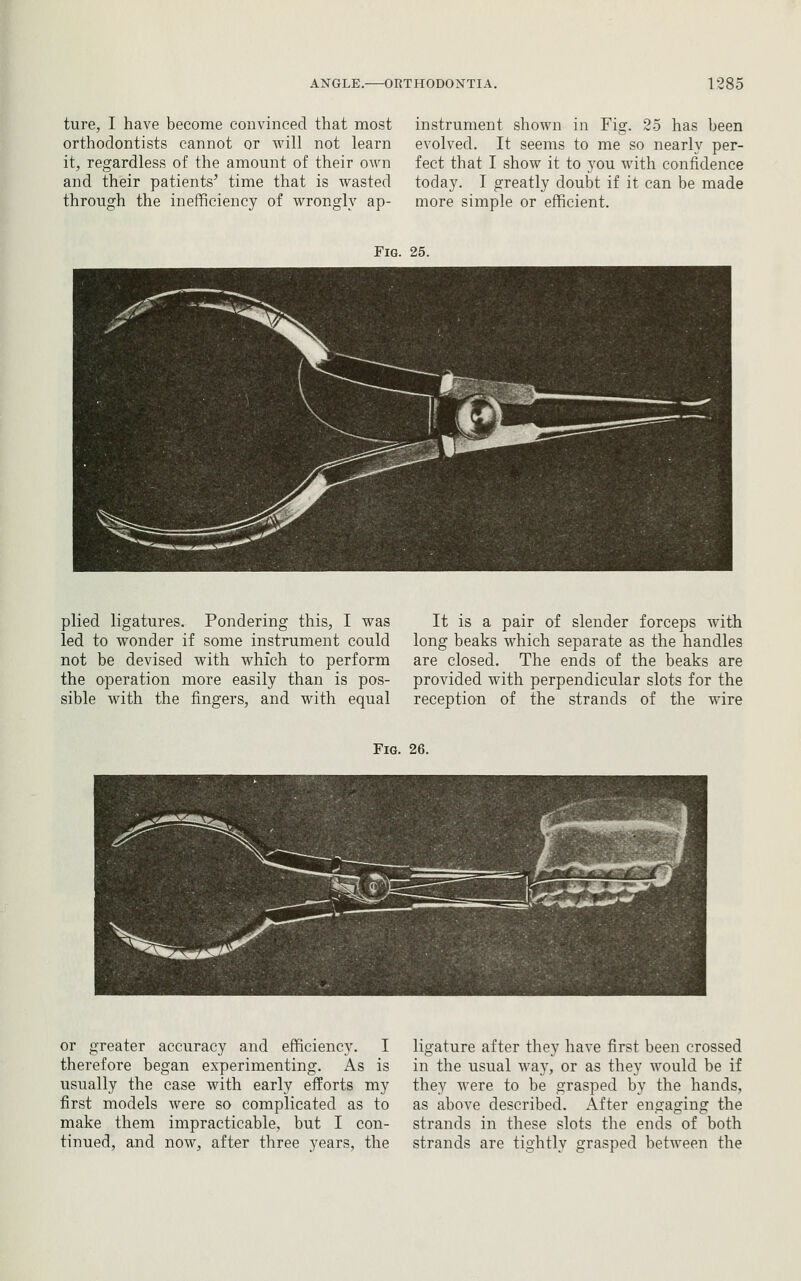 ture, I have become convinced that most orthodontists cannot or will not learn it, regardless of the amount of their own and their patients' time that is wasted through the inefficiency of wrongly ap- instrument shown in Fig. 25 has been evolved. It seems to me so nearly per- fect that I show it to you Avith confidence today. I greatly doubt if it can be made more simple or efficient. Fig. 25. ^■^ ^^ ^sstf^^ plied ligatures. Pondering this, I was led to wonder if some instrument could not be devised with which to perform the operation more easily than is pos- sible with the fingers, and with equal It is a pair of slender forceps with long beaks which separate as the handles are closed. The ends of the beaks are provided with perpendicular slots for the reception of the strands of the wire Fig. 26. or greater accuracy and efficiency. I therefore began experimenting. As is usually the case with early efforts my first models were so complicated as to make them impracticable, but I con- tinued, and now, after three years, the ligature after they have first been crossed in the usual way, or as they would be if they were to be grasped by the hands, as above described. After engaging the strands in these slots the ends of both strands are tightly grasped between the