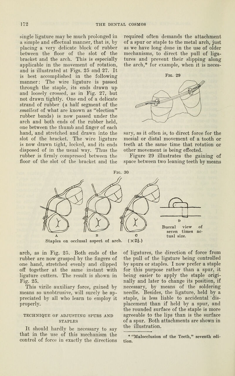 single ligature may be much prolonged in a simple and effectual manner, that is, by placing a very delicate block of rubber between the floor of the slot of the bracket and the arch. This is especially applicable in the movement of rotation, and is illustrated at Figs. 25 and 27. It is best accomplished in the following manner: The wire ligature is passed through the staple, its ends drawn up and loosely crossed, as in Pig. 27, but not drawn tightly. One end of a delicate strand of rubber (a half segment of the smallest of what are known as election rubber bands) is now passed under the arch and both ends of the rubber held, one between the thumb and finger of each hand, and stretched and drawn into the slot of the bracket. The wire ligature is now drawn tight, locked, and its ends disposed of in the usual way. Thus the rubber is firmly compressed between the floor of the slot of the bracket and the required often demands the attachment of a spur or staple to the metal arch, just as we have long done in the use of older mechanisms, to direct the pull of liga- tures and prevent their slipping along the arch,* for example, when it is neces- FiG. 29 sary, as it often is, to direct force for the mesial or distal movement of a tooth or teeth at the same time that rotation or other movement is being effected. Figure 29 illustrates the gaining of space between two leaning teeth by means Fig. 30 r^ A B Staples on occlusal aspect of arch. arch, as in Fig. 25. Both ends of the rubber are now grasped by the fingers of one hand, stretched evenly and clipped off together at the same instant with ligature cutters. The result is shown in Fig. 25. This virile auxiliary force, gained by means so unobtrusive, will surely be ap- preciated by all who learn to employ it properly. TECHNIQUE OF ADJUSTING SPURS AND STAPLES It should hardly be necessary to say that in the use of this mechanism the control of force in exactly the directions o (X2i.) D Buccal view of seven times ac- tual size. of ligatures, the direction of force from the pull of the ligature being controlled by spurs or staples. I now prefer a staple for this purpose rather than a spur, it being easier to apply the staple origi- nally and later to change its position, if necessary, by means of the soldering needle. Besides, the ligature, held by a staple, is less liable to accidental 'dis- placement than if held by a spur, and the rounded surface of the staple is more agreeable to the lips than is the surface of a spur. Both attachments are shown in the illustration. * Malocclusion of the Teeth, seventh edi- tion.