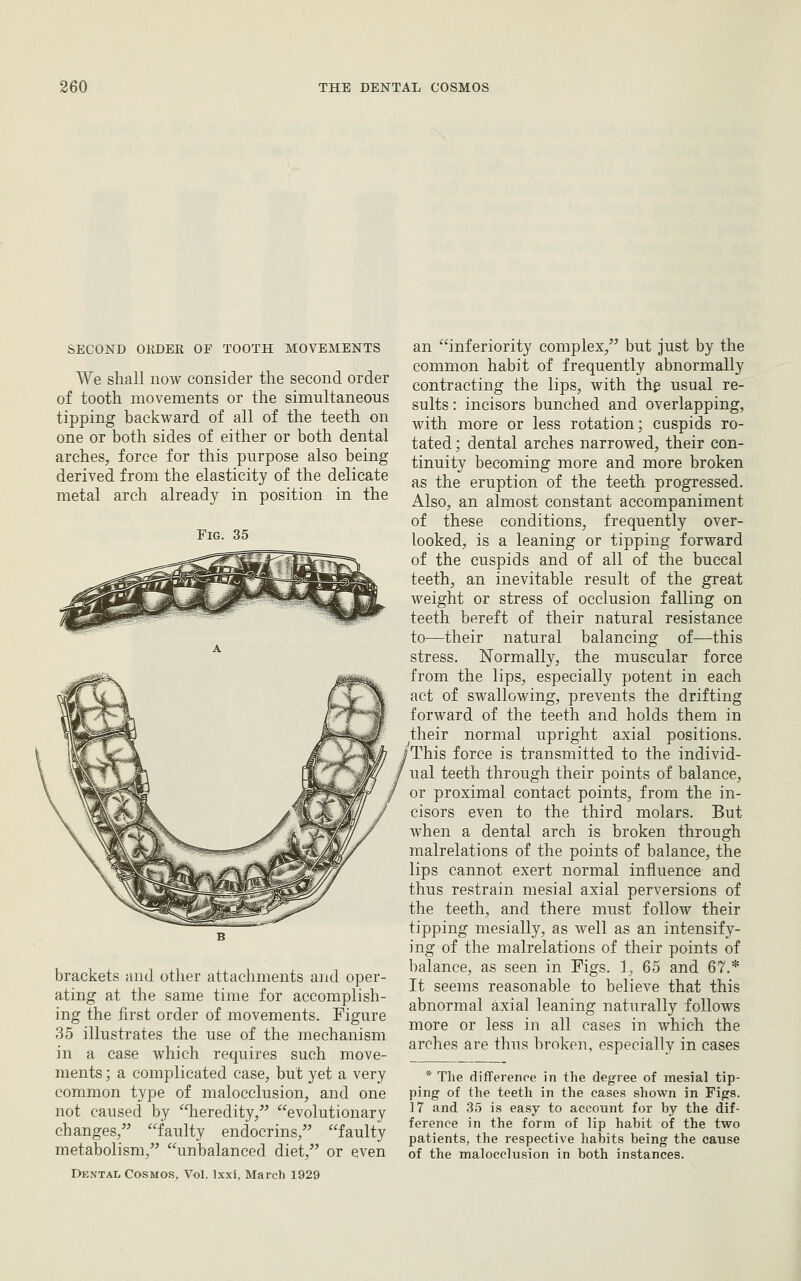 SECOND OKDEE OF TOOTH MOVEMENTS We shall now consider the second order of tooth movements or the simultaneous tipping backward of all of the teeth on one or both sides of either or both dental arches, force for this purpose also being derived from the elasticity of the delicate metal arch already in position in the Fig. 35 brackets and other attachments and oper- ating at the same time for accomplish- ing the first order of movements. Figure 35 illustrates the use of the mechanism in a case Avhich requires such move- ments ; a complicated case, but yet a very common type of malocclusion, and one not caused by heredity, evolutionary changes,'^ faulty endocrins, faulty metabolism, unbalanced diet, or even Dental Cosmos, Vol. Ixxi, March 1929 an inferiority complex, but just by the common habit of frequently abnormally contracting the lips, with the usual re- sults : incisors bunched and overlapping, with more or less rotation; cuspids ro- tated; dental arches narrowed, their con- tinuity becoming more and more broken as the eruption of the teeth progressed. Also, an almost constant accompaniment of these conditions, frequently over- looked, is a leaning or tipping forward of the cuspids and of all of the buccal teeth, an inevitable result of the great weight or stress of occlusion falling on teeth bereft of their natural resistance to—^their natural balancing of—this stress. Normally, the muscular force from the lips, especially potent in each act of swallowing, prevents the drifting forward of the teeth and holds them in their normal upright axial positions. /This force is transmitted to the individ- ual teeth through their points of balance, or proximal contact points, from the in- cisors even to the third molars. But when a dental arch is broken through malrelations of the points of balance, the lips cannot exert normal influence and thus restrain mesial axial perversions of the teeth, and there must follow their tipping mesially, as well as an intensify- ing of the malrelations of their points of balance, as seen in Figs. ], 65 and 67.* It seems reasonable to believe that this abnormal axial leaning naturally follows more or less in all cases in which the arches are thus broken, especially in cases * The difference in the degree of mesial tip- ping of the teeth in the cases shown in Figs. 17 and .35 is easy to account for by the dif- ference in the form of lip habit of the two patients, the respective habits being the cause of the malocclusion in both instances.