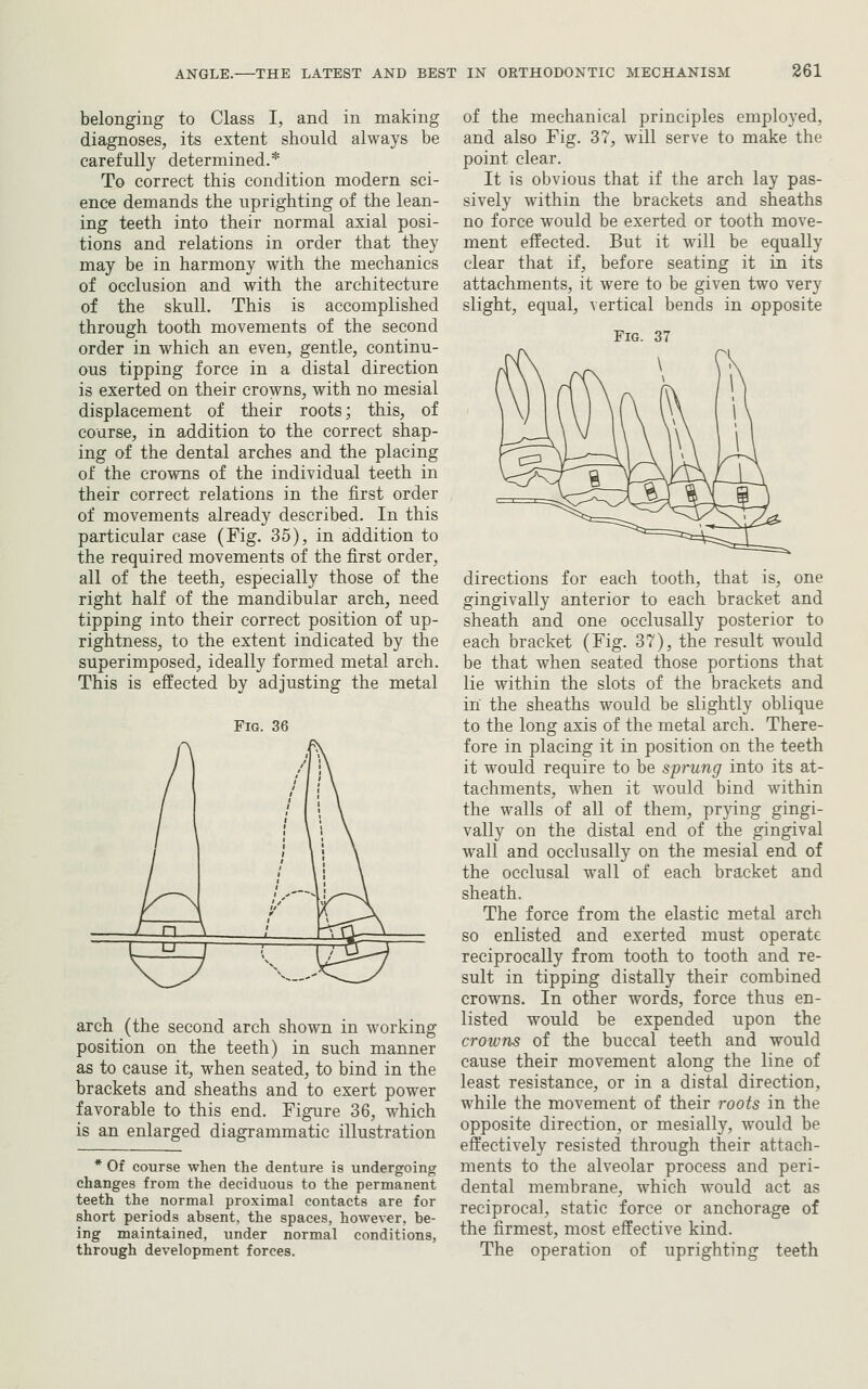 belonging to Class I, and in making diagnoses, its extent should always be carefully determined.* To correct this condition modern sci- ence demands the uprighting of the lean- ing teeth into their normal axial posi- tions and relations in order that they may be in harmony with the mechanics of occlusion and with the architecture of the skull. This is accomplished through tooth movements of the second order in which an even, gentle, continu- ous tipping force in a distal direction is exerted on their crowns, with no mesial displacement of their roots; this, of coarse, in addition to the correct shap- ing of the dental arches and the placing of the crowns of the individual teeth in their correct relations in the first order of movements already described. In this particular case (Fig. 35), in addition to the required movements of the first order, all of the teeth, especially those of the right half of the mandibular arch, need tipping into their correct position of up- rightness, to the extent indicated by the superimposed, ideally formed metal arch. This is effected by adjusting the metal Fig. 36 ^ \..}& arch (the second arch shown in working position on the teeth) in such manner as to cause it, when seated, to bind in the brackets and sheaths and to exert power favorable to this end. Figure 36, which is an enlarged diagrammatic illustration * Of course when the denture is undergoing changes from the deciduous to the permanent teeth the normal proximal contacts are for short periods absent, the spaces, however, be- ing maintained, under normal conditions, through development forces. of the mechanical principles employed, and also Fig. 37, will serve to make the point clear. It is obvious that if the arch lay pas- sively within the brackets and sheaths no force would be exerted or tooth move- ment effected. But it will be equally clear that if, before seating it in its attachments, it were to be given two very slight, equal, vertical bends in opposite Fig. 37 directions for each tooth, that is, one gingivally anterior to each bracket and sheath and one occlusally posterior to each bracket (Fig. 37), the result would be that when seated those portions that lie within the slots of the brackets and in the sheaths would be slightly oblique to the long axis of the metal arch. There- fore in placing it in position on the teeth it would require to be sprung into its at- tachments, when it would bind within the walls of all of them, pr}dng gingi- vally on the distal end of the gingival wall and occlusally on the mesial end of the occlusal wall of each bracket and sheath. The force from the elastic metal arch so enlisted and exerted must operate reciprocally from tooth to tooth and re- sult in tipping distally their combined crowns. In other words, force thus en- listed would be expended upon the crowns of the buccal teeth and would cause their movement along the line of least resistance, or in a distal direction, while the movement of their roots in the opposite direction, or mesially, would be effectively resisted through their attach- ments to the alveolar process and peri- dental membrane, which would act as reciprocal, static force or anchorage of the firmest, most effective kind. The operation of uprighting teeth
