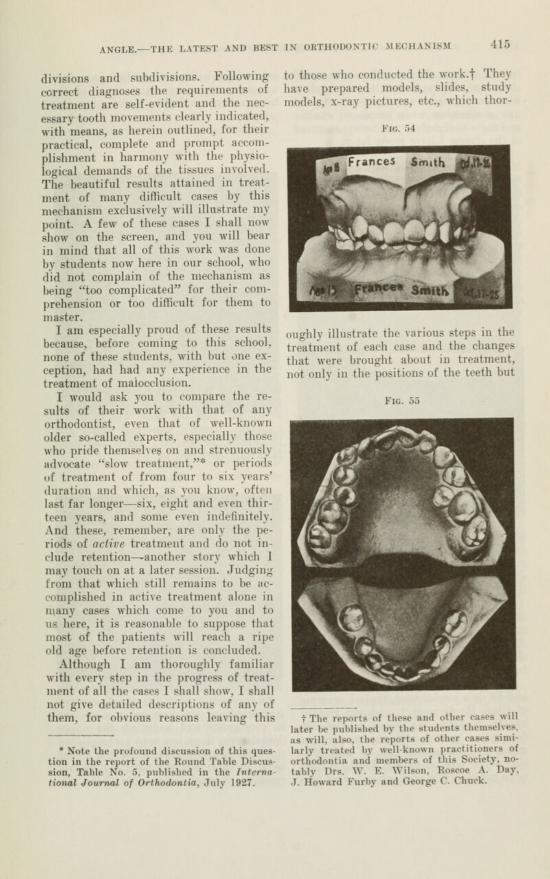 divisions and subdivisions. Following correct diagnoses the requirements of treatment are self-evident and the nec- essary tooth movements clearly indicated, with means, as herein outlined, for their practical, complete and prompt accom- plishment in harmony with the physio- logical demands of the tissues involved. The beautiful results attained in treat- ment of many difficult cases by this mechanism exclusively will illustrate my point. A few of these cases I shall now show on the screen, and you will bear in mind that all of this work was done by students now here in our school, who did not complain of the mechanism as being too complicated for their com- prehension or too difficult for them to master. I am especially proud of these results because, before coming to this school, none of these students, with but one ex- ception, had had any experience in the treatment of malocclusion. I would ask you to compare the re- sults of their work with that of any orthodontist, even that of well-known older so-called eitperts, especially those who pride themselves on and strenuously advocate slow treatment,* or periods of treatment of from four to six years' duration and which, as you know, often last far longer—six, eight and even thir- teen years, and some even indefinitely. And these, remember, are only the pe- riods of active treatment and do not in- clude retention—another story which I may touch on at a later session. Judging from that which still remains to be ac- complished in active treatment alone in niany cases which come to you and to us here, it is reasonable to suppose that most of the patients will reach a ripe old age before retention is concluded. Although I am thoroughly familiar with every step in the progress of treat- ment of all the cases I shall show, I shall not give detailed descriptions of any of them, for obvious reasons leaving this to those who conducted the work.f They have prepared models, slides, study models, x-ray pictures, etc., which thor- FiG. 54 oughly illustrate the various steps in the treatment of each case and the changes that were brought about in treatment, not only in the positions of the teeth but Fig. 55 * Note the profound discussion of this ques- tion in the report of the Round Table Discus- sion, Table No. 5, published in the Interna- tional Journal of Orthodontia, July 1927. t The reports of these and other cases will later be published by the students themselves, as will, also, the reports of other cases simi- larly treated by well-known practitioners of orthodontia and members of this Society, no- tably Drs. W. E. Wilson, Roscoe A. Day, J. Howard Furby and George C. Chuck.