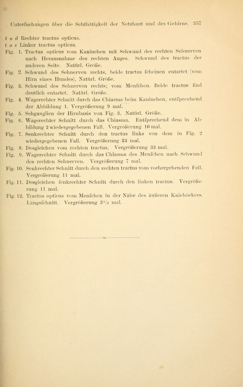 t u d Kediter tractiis opticus. t ü s Linker tractus opticus. Fig. 1. Tractus opticus vom Kaninclien mit Schwund des reciiten Sehnerven nach Herausnahme des reciiten Auges. Schwund des tractus der anderen Seite. Natur]. Größe. Fig. 2. Schwund des Sehnerven rechts, beide tractus fclieinen entartet (vom Hirn eines Hunde.s). Natürl. Größe. Fig. 3. Schwund des Sehnerven rechts; vom Menfchen. Beide tractus find deutlich entartet. Natürl. Größe. Fig. 4. AVagerechter Schnitt durch das Chiasma beim Kaninchen, entfprecliend der Aljbildung 1. Vergrößerung 9 mal. Fig. .5. Sehganglien der Hirnbasis von Fig. 3. Natürl. Größe. Fig. 6. Wagerechter Schnitt durch das Chiasma. Entfprechend dem in Al)- bildung 2 wiedergegebenen Fall. Vergrößerung 10 mal. Fig. 7. Senkrechter Schnitt durch den tractus links von dem in Fig. 2 wiedergegebenen Fall. Vergrößerung 33 mal. Fig. 8. Desgleichen vom rechten tractus. Vergrößerung 33 mal. Fig. P. AVagerechter Schnitt durch das Chiasma des ?ilenfchen nach Schwund des rechten Sehnerven. Vergrößerung 7 mal. Fig. 10. Senkrechter Schnitt durch den rechten tractus vom voihei-gehenden Fall. Vergrößerung 11 mal. Fig. 11. Desgleichen Tenkrechter Schnitt duii'h den linken tractus. Vergröße- rung 11 mal. Fig. 12. Tractus opticus vom Menfchen in der Nähe des äußeren Kniehöckers. I.ängsfchnitt. N'ergrößerung S'/a mal.