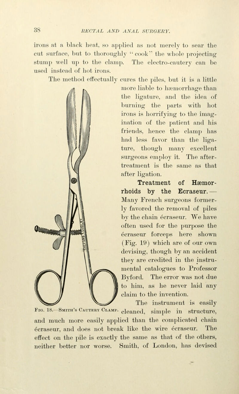 irons at a black lieat, so applied as not merely to sear the cut surface, but to thoroughly cook the whole projecting stump well up to the clamp. The electro-cautery can be used instead of hot irons. The method effectually cures the piles, but it is a little more liable to haemorrhage than the ligature, and the idea of burning the parts with hot irons is horrifying to the imag- ination of the patient and his friends, hence the clamp has had less favor than the liga- ture, though many excellent surgeons employ it. The after- treatment is the same as that after ligation. Treatment of Haemor- rhoids by the Ecraseur.— Many French surgeons former- ly favored the removal of piles by the chain ecraseur. We have often used for the purpose the Ecraseur forceps here shown (Fig. 19) which are of our own devising, though by an accident they are credited in the instru- mental catalogues to Professor Byford. The error was not due to him, as he never laid any claim to the invention. The instrument is easily -Smith's Cauteey Clamp, gleaned, simple in structure, and much more easily applied than the complicated chain Ecraseur, and does not break like the wire ecraseur. The effect on the pile is exactly the same as that of the others, neither better nor worse. Smith, of London, has devised Fig. 18.