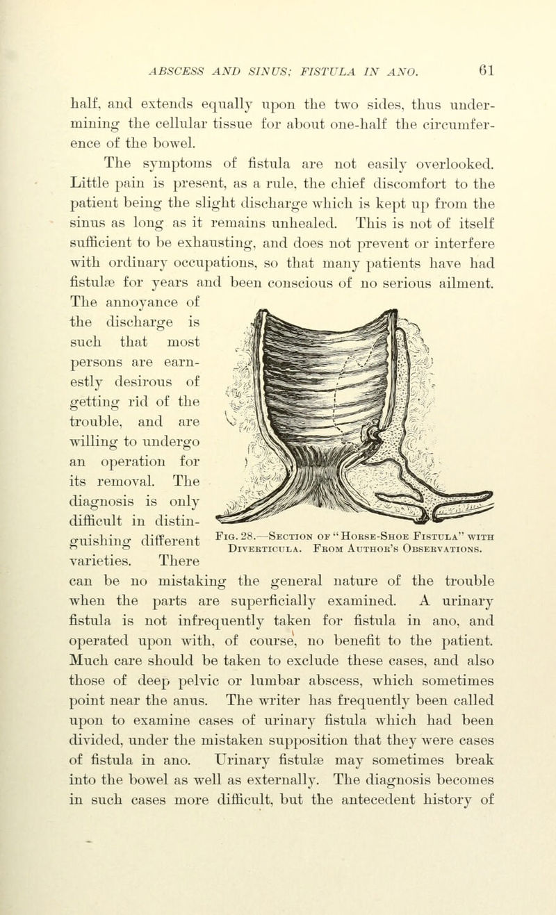 half, and extends equally upon the two sides, thus under- mining the cellular tissue for about one-half the circumfer- ence of the bowel. The symptoms of hstula are not easily overlooked. Little pain is present, as a rule, the chief discomfort to the patient being the slight discharge which is kept up from the sinus as long as it remains unhealed. This is not of itself sufficient to be exhausting, and does not prevent or interfere with ordinary occupations, so that many patients have had fistuljB for years and been conscious of no serious ailment. The annoyance of the discharge is such that most persons are earn- estly desirous of getting rid of the trouble, and are willing to undergo an operation for its removal. The diagnosis is only difficult in distin- guishing different varieties. There can be no mistaking the general nature of the trouble when the parts are superficially examined. A urinary fistula is not infrequently taken for fistula in ano, and operated upon with, of course, no benefit to the patient. Much care should be taken to exclude these cases, and also those of deep pelvic or lumbar abscess, which sometimes point near the anus. The writer has frequently been called upon to examine cases of urinary fistula which had been divided, under the mistaken supposition that they were cases of fistula in ano. Urinary fistulee may sometimes break into the bowel as well as externally. The diagnosis becomes in such cases more difficult, but the antecedent history of Fig. 28.—Section ofHobse-Shoe Fistula with Diverticula. Feom Authob's Obsebvations.