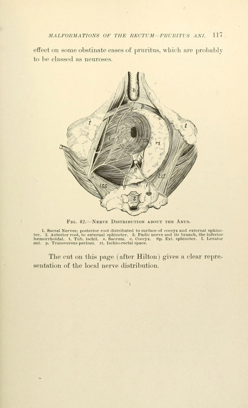 effect on some obstinate cases of pruritus, which are probably to be classed as neuroses. Fig. 42.—Nebve Distkibution about the Anus. 1. Sacral Nerves; posterior root distributed to surface of coccyx and external sphinc- ter. 2. Anterior root, to external sphincter. 3. Pudic nerve and its branch, the inferior hiemorrhoidal. t. Tub. ischii. s. Sacrum, c. Coccyx. Sp. Ext. sphincter. I. Levator ani. p. Transversus periuei. ri. Ischio-rectal space. The cut on this page (after Hilton) gives a clear repre- sentation of the local nerve distribution.