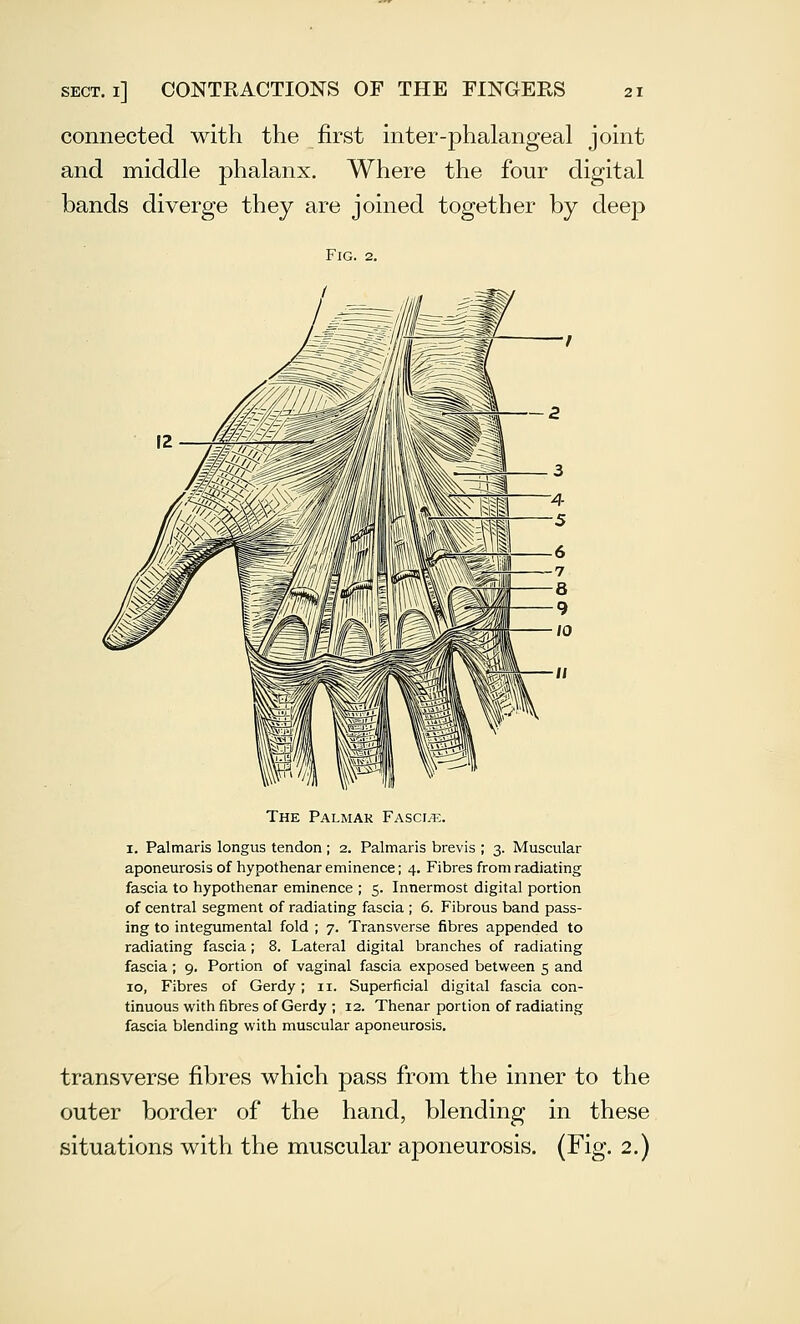 connected with the first inter-phalangeal joint and middle phalanx. Where the four digital bands diverge they are joined together by deep Fig. 2. The Palmar Fasciae. I. Palmaris longus tendon ; 2. Palmaris brevis ; 3. Muscular aponeurosis of hypothenar eminence; 4. Fibres from radiating fascia to hypothenar eminence ; 5. Innermost digital portion of central segment of radiating fascia ; 6. Fibrous band pass- ing to integumental fold ; 7. Transverse fibres appended to radiating fascia; 8. Lateral digital branches of radiating fascia ; 9. Portion of vaginal fascia exposed between 5 and ID, Fibres of Gerdy ; 11. Superficial digital fascia con- tinuous with fibres of Gerdy ; 12. Thenar portion of radiating fascia blending with muscular aponeurosis. transverse fibres which pass from the inner to the outer border of the hand, blending in these situations with the muscular aponeurosis. (Fig. 2.)