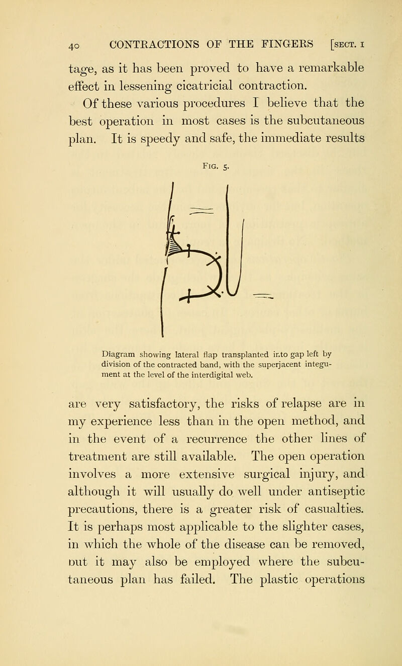 tage, as it has been proved to have a remarkable effect in lessening cicatricial contraction. Of these various procedures I believe that the best operation in most cases is the subcutaneous plan. It is speedy and safe, the immediate results Fig. s. Diagram showing lateral flap transplanted into gap left by division of the contracted band, with the superjacent integu- ment at the level of the interdigital web. are very satisfactory, the risks of relapse are in my experience less than in the open method, and in the event of a recurrence the other lines of treatment are still available. The open operation involves a more extensive surgical injury, and although it will usually do well under antiseptic precautions, there is a greater risk of casualties. It is perhaps most applicable to the slighter cases, in which the whole of the disease can be removed, out it may also be employed where the subcu- taneous plan has failed. The plastic operations