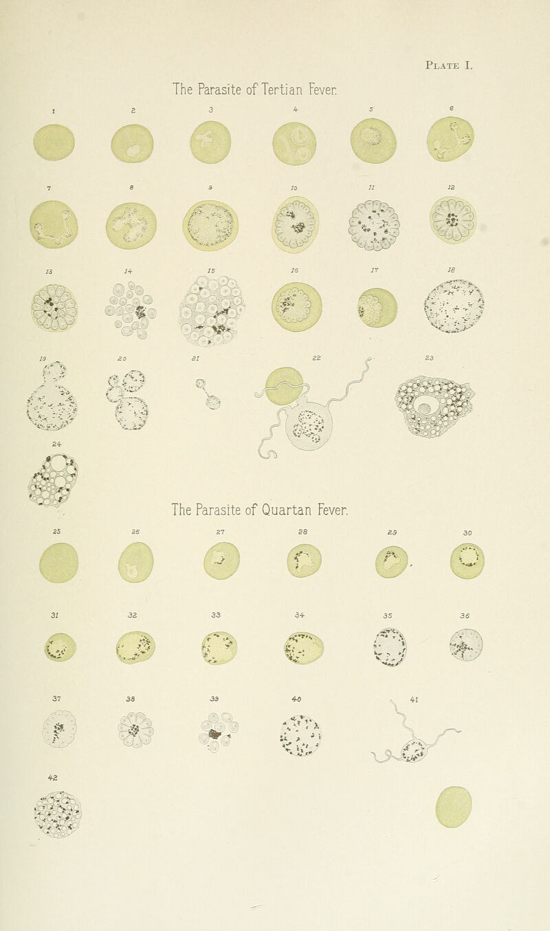 <^^ The Parasite of Tertian Fever. Vi: \# /Th w^ >-^ ~-^- 1^:*^* — >1_. ' ■ *--: 20 at '-7^:''?% ^ ^- v4 ^ '■■ i^ -C' The Parasite of Quartan Fever. fc3' ■At. ■*.*' 54- iS? ^