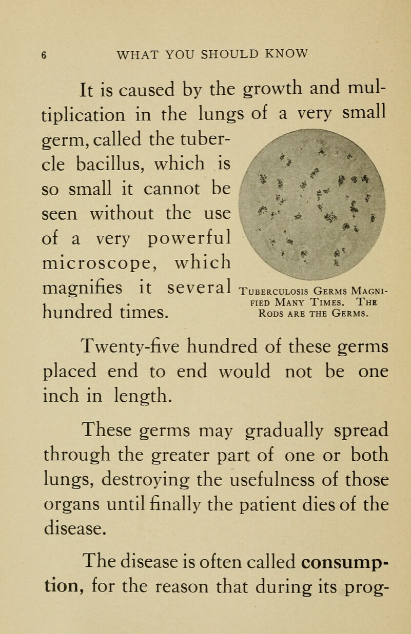 It is caused by the growth and mul- tiplication in the lungs of a very small germ, called the tuber- cle bacillus, which is so small it cannot be seen without the use of a very powerful microscope, which magnifies it several tuberculosis germs magni- , , , fied Many Times. The hundred times. rods are the germs. Twenty-five hundred of these germs placed end to end would not be one inch in length. These germs may gradually spread through the greater part of one or both lungs, destroying the usefulness of those organs until finally the patient dies of the disease. The disease is often called consump- tion, for the reason that during its prog-