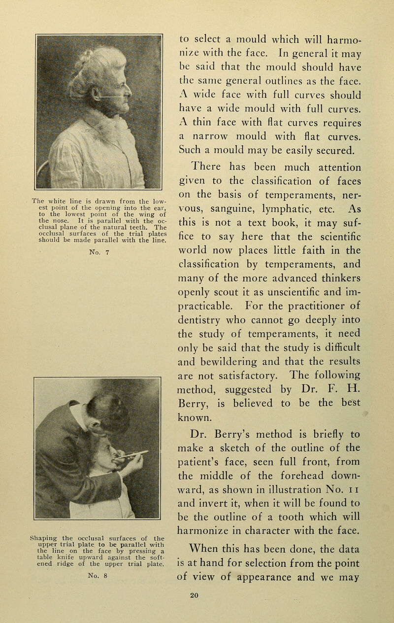 The white line is drawn from the low- est point of the opening into the ear, to the lowest point of the wing of the nose. It is parallel with the oc- clusal plane of the natural teeth. The occlusal surfaces of the trial plates should be made parallel with the line. No. 7 Shaping the occlusal surfaces of the upper trial plate to be parallel with the line on the face by pressing a table knife upward against the soft- ened ridge of the upper trial plate. No. 8 to select a mould which will harmo- nize with the face. In general it may be said that the mould should have the same general outlines as the face. A wide face with full curves should have a wide mould with full curves. A thin face with flat curves requires a narrow mould with flat curves. Such a mould may be easily secured. There has been much attention given to the classification of faces on the basis of temperaments, ner- vous, sanguine, lymphatic, etc. As this is not a text book, it may suf- fice to say here that the scientific world now places little faith in the classification by temperaments, and many of the more advanced thinkers openly scout it as unscientific and im- practicable. For the practitioner of dentistry who cannot go deeply into the study of temperaments, it need only be said that the study is difficult and bewildering and that the results are not satisfactory. The following method, suggested by Dr. F. H. Berry, is believed to be the best known. Dr. Berry's method is briefly to make a sketch of the outline of the patient's face, seen full front, from the middle of the forehead down- ward, as shown in illustration No. ii and invert it, when it will be found to be the outline of a tooth which will harmonize in character with the face. When this has been done, the data is at hand for selection from the point of view of appearance and we may