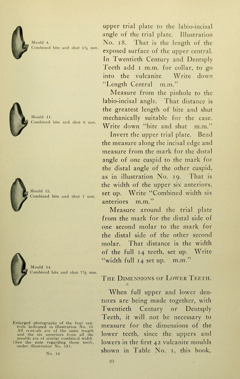 Mould 4. Conibiiied bite and shut iV^ mm. Mould 11. Combined bite and shut 6 mm. Mould 13. Combined bite and shut 7 mm. Mould 14. Combined bite and shut TV^ mm. Enlarged photographs of the four cen- trals indicated m illustration No. 13 All ctntrals are of the same length and the six anteriors from all the moulds are of similar combined width (See the note regarding these teetli, under illustration No. 13). No. 14 upper trial plate to the labio-Incisal angle of the trial plate. Illustration No. 18. That is the length of the exposed surface of the upper central. In Twentieth Century and Dentsply Teeth add i m.m. for collar, to go into the vulcanite. Write down Length Central m.m. Measure from the pinhole to the labio-incisal angle. That distance is the greatest length of bite and shut mechanically suitable for the case. Write down bite and shut m.m. Invert the upper trial plate. Bend the measure along the incisal edge and measure from the mark for the distal angle of one cuspid to the mark for the distal angle of the other cuspid, as in illustration No. 19. That is the width of the upper six anteriors, set up. Write Combined width six anteriors m.m. Measure around the trial plate from the mark for the distal side of one second molar to the mark for the distal side of the other second molar. That distance is the width of the full 14 teeth, set up. Write width full 14 set up. m.m. The Dimensions of Lovi^er Teeth. When full upper and lower den- tures are being made together, with Twentieth Century or Dentsply Teeth, it will not be necessary to measure for the dimensions of the lower teeth, since the uppers and lowers in the first 42 vulcanite moulds shown in Table No. i, this book,