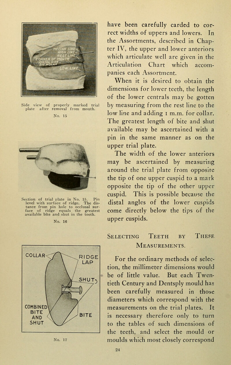 Side view of properly marked trial plate after removal from mouth. No. 15 Section of trial plate in No. 1.5. Pin level with surface of ridge. The dis- tance from pin hole to occlusal sur- face of ridge equals the greatest available bite and shut in the tooth. No. 16 have been carefully carded to cor- rect widths of uppers and lowers. In the Assortments, described in Chap- ter IV, the upper and lower anteriors which articulate well are given in the Articulation Chart which accom- panies each Assortment. When it is desired to obtain the dimensions for lower teeth, the length of the lower centrals may be gotten by measuring from the rest line to the low line and adding i m.m, for collar. The greatest length of bite and shut available may be ascertained with a pin in the same manner as on the upper trial plate. The width of the lower anteriors may be ascertained by measuring around the trial plate from opposite the tip of one upper cuspid to a mark opposite the tip of the other upper cuspid. This is possible because the distal angles of the lower cuspids come directly below the tips of the upper cuspids. COLLAR COMBINED BITE AND SHUT No. 17 RIDGE LAP BITE Selecting Teeth by Measurements. These For the ordinary methods of selec- tion, the millimeter dimensions would be of little value. But each Twen- tieth Century and Dentsply mould has been carefully measured in those diameters which correspond with the measurements on the trial plates. It is necessary therefore only to turn to the tables of such dimensions of the teeth, and select the mould or moulds which most closely correspond