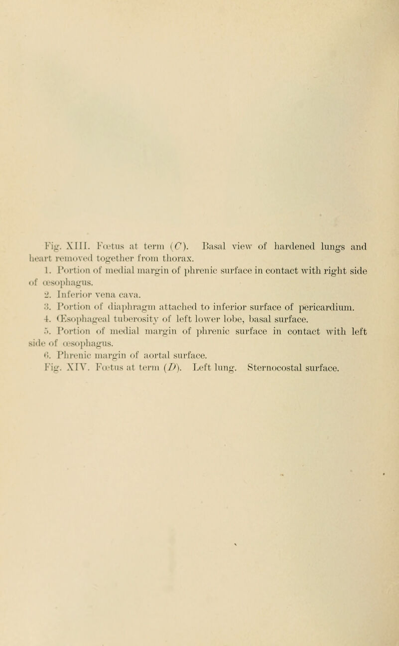 Fig. Xlll. FcL'tus at tonn iC). liasal view of hardened lungs and heart removed togetliei- IVoni thorax. 1. Portion of medial margin of phrenic surface in contact with right side <if a'so])hagus. J. IntVrioi' vena cava. 3. Portion of dia])hragm attached to inferior surface of pericardium. 4. (Esophageal tuberosity of left lower lobe, basal surface. ... Portion of medial margin of phrenic surface in contact with left side of oesoj)hagus. «V Pliivnic margin of aortal surface.