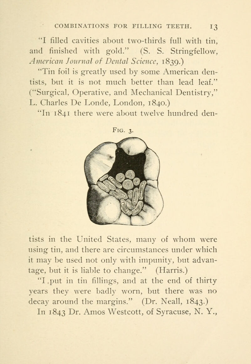 I filled cavities about two-thirds full with tin, and finished with gold. (S. S. Stringfellow, American Journal of Dental Science, 1839.) Tin foil is greatly used by some American den- tists, but it is not much better than lead leaf. (Surgical, Operative, and Mechanical Dentistry, L. Charles De Londe, London, 1840.) *Tn 1841 there were about twelve hundred den- FlG. 3. tists in the United States, many of whom were using tin, and there are circumstances under which it may be used not only with impunity, but advan- tage, but it is liable to change. (Harris.) I ,put in tin fillings, and at the end of thirty years they were badly worn, but there was no decay around the margins. (Dr. Neall, 1843.) In 1843 Dr. Amos Westcott, of Syracuse, N. Y.,