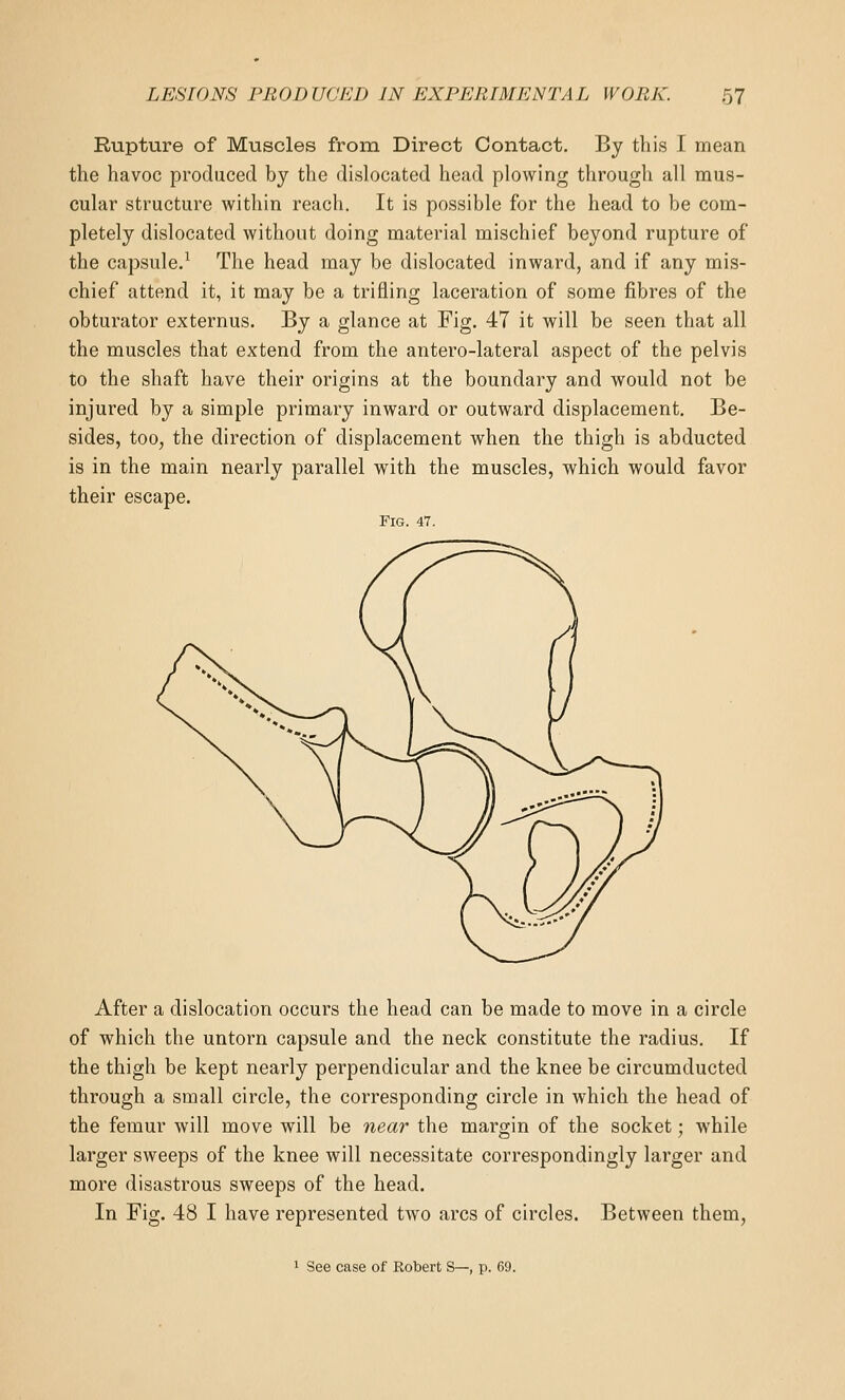 Rupture of Muscles from Direct Contact. By this I mean the havoc produced by the dislocated head plowing through all mus- cular structure within reach. It is possible for the head to be com- pletely dislocated without doing material mischief beyond rupture of the capsule.^ The head may be dislocated inward, and if any mis- chief attend it, it may be a trifling laceration of some fibres of the obturator externus. By a glance at Fig. 47 it will be seen that all the muscles that extend from the antero-lateral aspect of the pelvis to the shaft have their origins at the boundary and would not be injured by a simple primary inward or outward displacement. Be- sides, too, the direction of displacement when the thigh is abducted is in the main nearly parallel with the muscles, which would favor their escape. Fig. 47. After a dislocation occurs the head can be made to move in a circle of which the untorn capsule and the neck constitute the radius. If the thigh be kept nearly perpendicular and the knee be circumducted through a small circle, the corresponding circle in which the head of the femur will move will be near the margin of the socket; while larger sweeps of the knee will necessitate correspondingly larger and more disastrous sweeps of the head. In Fig. 48 I have represented two arcs of circles. Between them, 1 See case of Robert S—, p. 69.