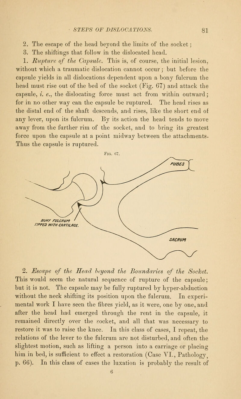 2. The escape of the head beyond the limits of the socket; 3. The shiftings that follow in the dislocated head. 1, Rupture of the Capsule. This is, of course, the initial lesion, without which a traumatic dislocation cannot occur; but before the capsule yields in all dislocations dependent upon a bony fulcrum the head must rise out of the bed of the socket (Fig. 67) and attack the capsule, i. e., the dislocating force must act from within outward; for in no other way can the capsule be ruptured. The head rises as the distal end of the shaft descends, and rises, like the short end of any lever, upon its fulcrum. By its action the head tends to move away from the further rim of the socket, and to bring its greatest force upon the capsule at a point midway between the attachments. Thus the capsule is ruptured. Fig. 67. savy ri/icftun riPP£D WITH CARTILAGE. 2. Escape of the Head beyond the Boundaries of the Socket. This would seem the natural sequence of rupture of the capsule; but it is not. The capsule may be fully ruptured by hyper-abduction without the neck shifting its position upon the fulcrum. In experi- mental work I have seen the fibres yield, as it were, one by one, and after the head had emerged through the rent in the capsule, it remained directly over the socket, and all that was necessary to restore it was to raise the knee. In this class of cases, I repeat, the relations of the lever to the fulcrum are not disturbed, and often the slightest motion, such as lifting a person into a carriage or placing him in bed, is sufficient to effect a restoration (Case VI., Pathology p. 66). In this class of cases the luxation is probably the result of 6