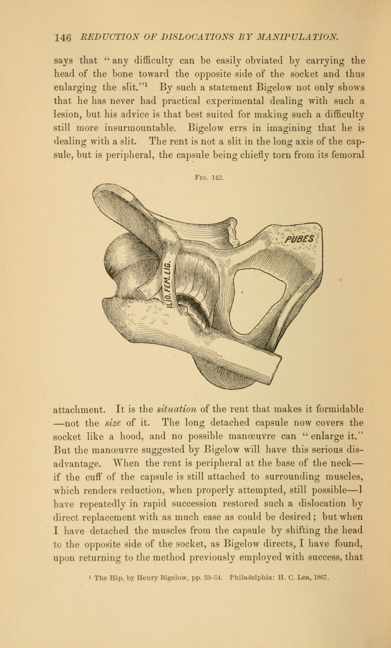 says that '* any difficulty can be easily obviated by carrying the head of the bone toward the opposite side of the socket and thus enlarging the slit.^ By such a statement Bigelow not only shows that he has never had practical experimental dealing with such a lesion, but his advice is that best suited for making such a difficulty still more insurmountable. Bigelow errs in imagining that he is dealing with a slit. The rent is not a slit in the long axis of the cap- sule, but is peripheral, the capsule being chiefly torn from its femoral Fig. 1-42. attachment. It is the situation of the rent that makes it formidable —not the size of it. The long detached capsule now covers the socket like a hood, and no possible manoeuvre can  enlarge it. But the manoeuvre suggested by Bigelow will have this serious dis- advantage. When the rent is peripheral at the base of the neck— if the cuff of the capsule is still attached to surrounding muscles, which renders reduction, when properly attempted, still possible—1 have repeatedly in rapid succession restored such a dislocation by direct replacement with as much ease as could be desired; but wdien I have detached the muscles from the capsule by shifting the head to the opposite side of the socket, as Bigelow directs, I have found, upon returning to the method previously emploj^ed with success, that 1 The Hip, by Henry Bigelow, pp. 33-34. Philadelphia: H. C. Lea, 1867.