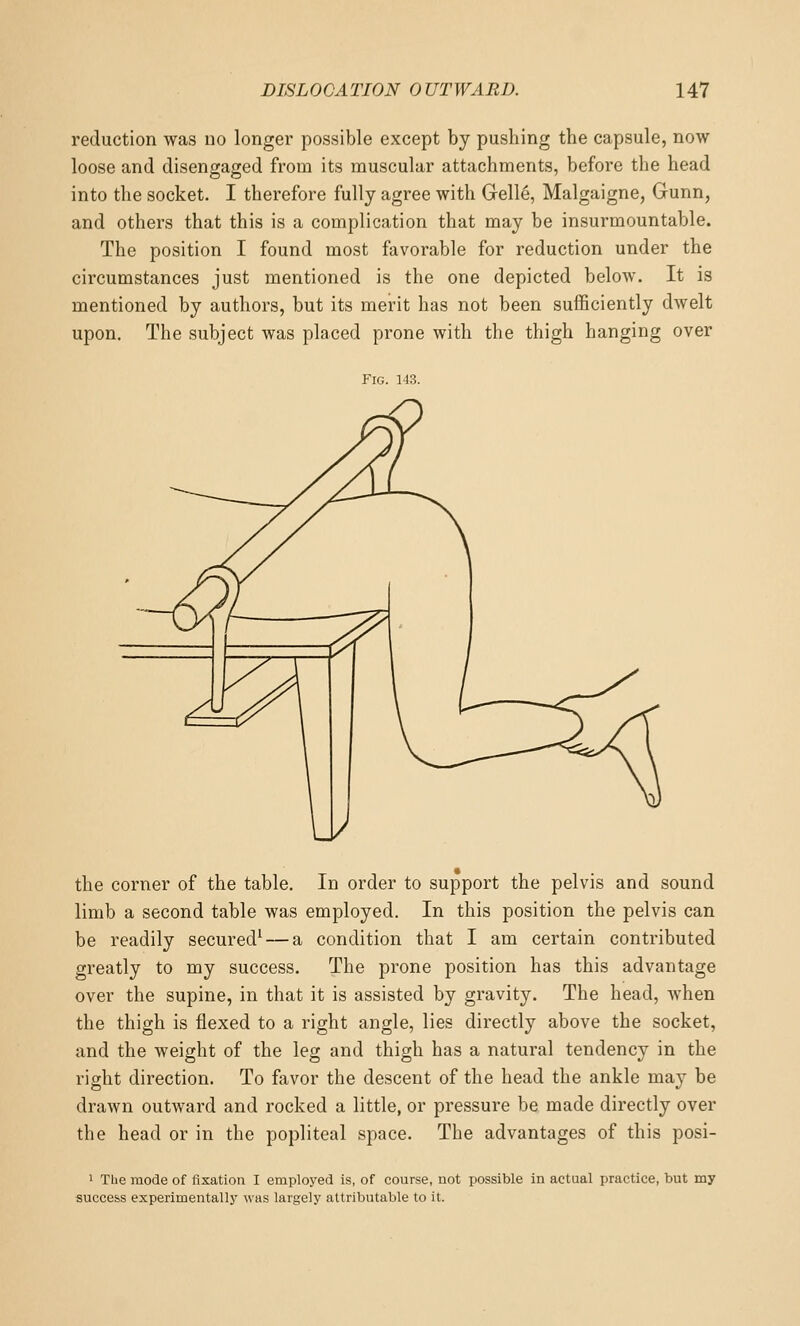 reduction was no longer possible except by pushing the capsule, now loose and disengaged from its muscular attachments, before the head into the socket. I therefore fully agree with Gelle, Malgaigne, Gunn, and others that this is a complication that may be insurmountable. The position I found most favorable for reduction under the circumstances just mentioned is the one depicted below. It is mentioned by authors, but its merit has not been sufficiently dwelt upon. The subject was placed prone with the thigh hanging over Fig. 143. the corner of the table. In order to support the pelvis and sound limb a second table was employed. In this position the pelvis can be readily secured^ — a condition that I am certain contributed greatly to my success. The prone position has this advantage over the supine, in that it is assisted by gravity. The head, when the thigh is flexed to a right angle, lies directly above the socket, and the weight of the leg and thigh has a natural tendency in the right direction. To favor the descent of the head the ankle may be drawn outward and rocked a little, or pressure be made directly over the head or in the popliteal space. The advantages of this posi- 1 Tlie mode of fixation I employed is, of course, not possible in actual practice, but my success experimentally was largely attributable to it.