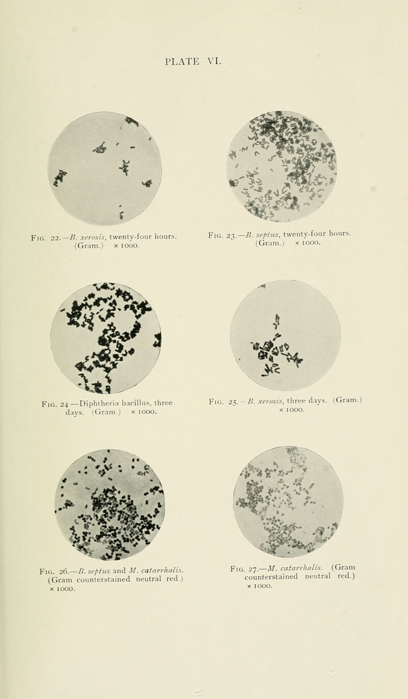 ^ / Fig. 22.—B. xerosis, twenty-four hours. (Gram.) x looo. Fig. 22.—B. septus, twenty-four hours. (Gram.^ x lOOO. Fig. 24—Diphtheria bacillus, three days. (Gram ) x 1000. ''it\ >le ^ Fig. 25.-5. xerosis, three days. (Gram.) X 1000. Fig. 26.—B. septus and M. catarrhalis. (Gram counterstained neutral red.) X 1000. /p%T?>-' * V-i '''^' '^'. <'&^^i^^' ^'^ ^Jr •^ PiQ_ 27.—M. catarrhalis. (Gram counterstained neutral red.) X 1000.